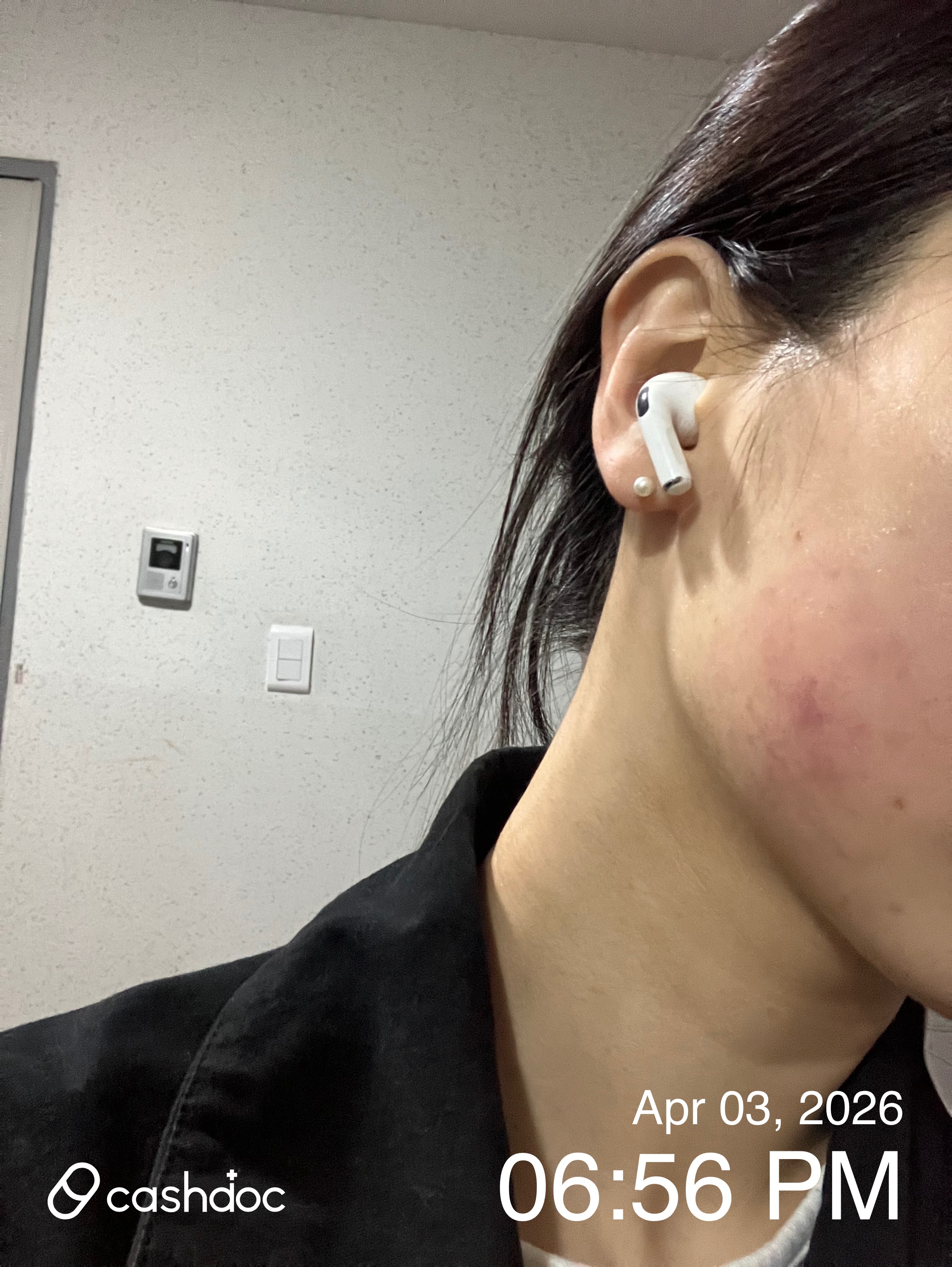 금천구 메이퓨어의원, 첫 방문 인모드 시술 후기