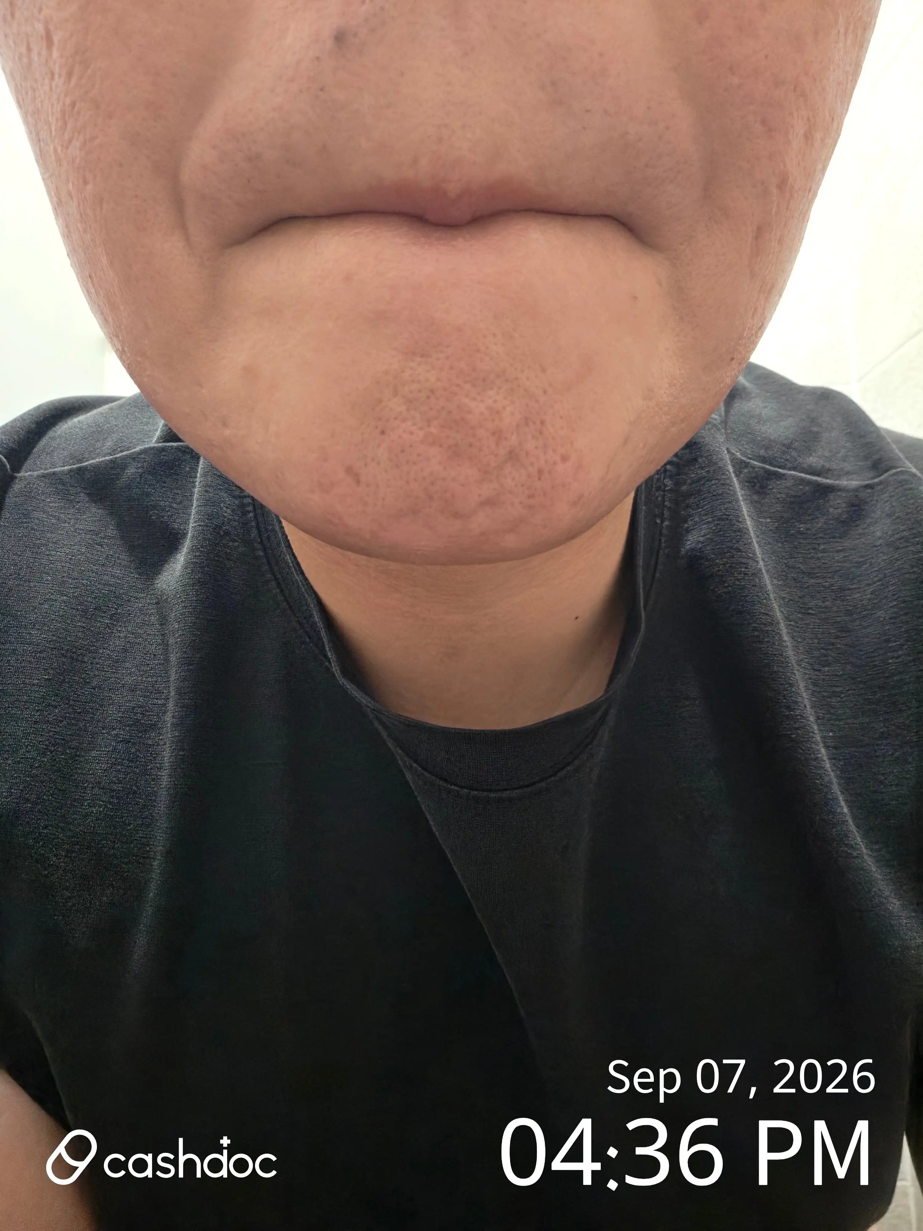 评价照片