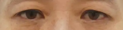 전