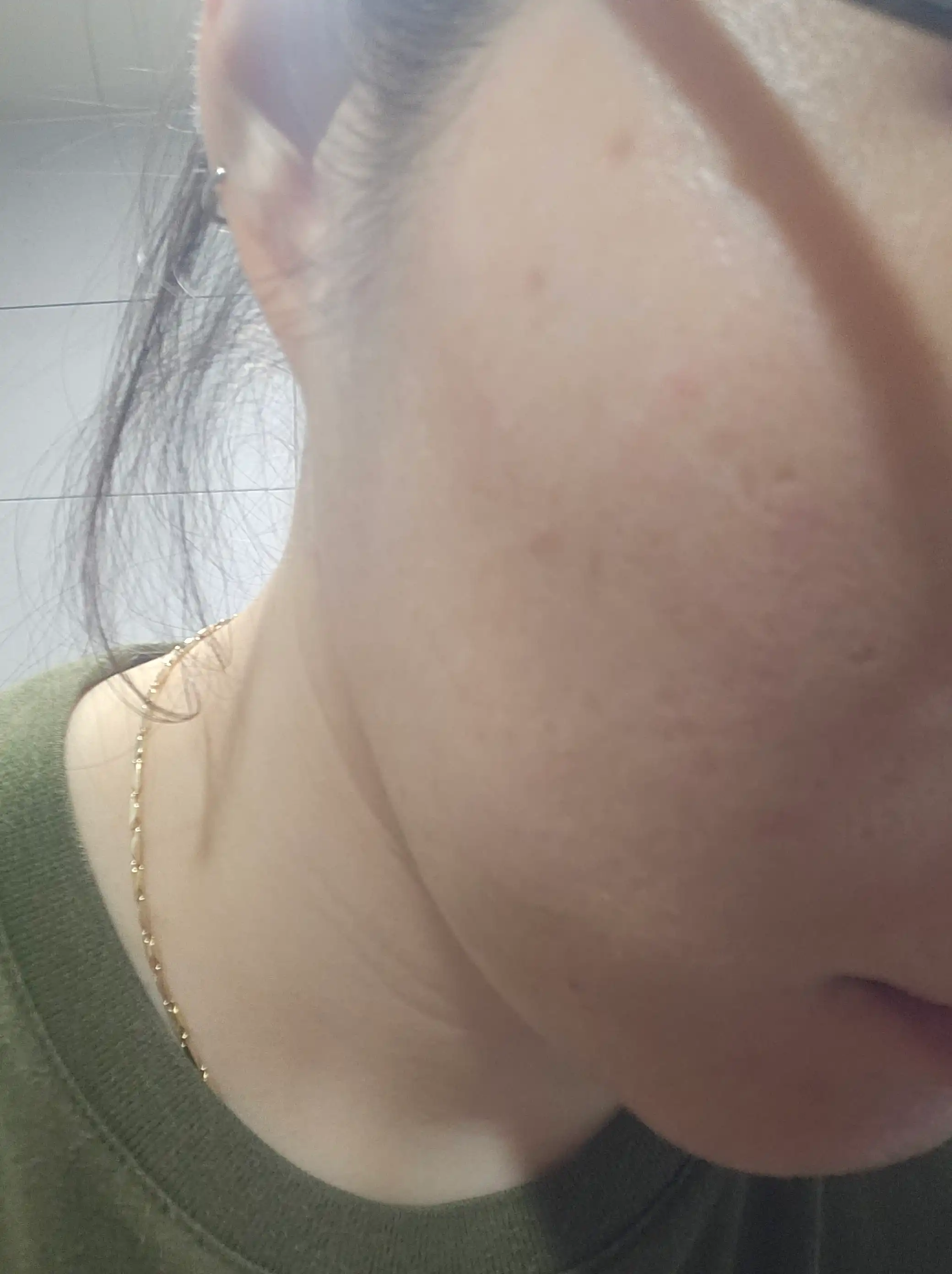 후