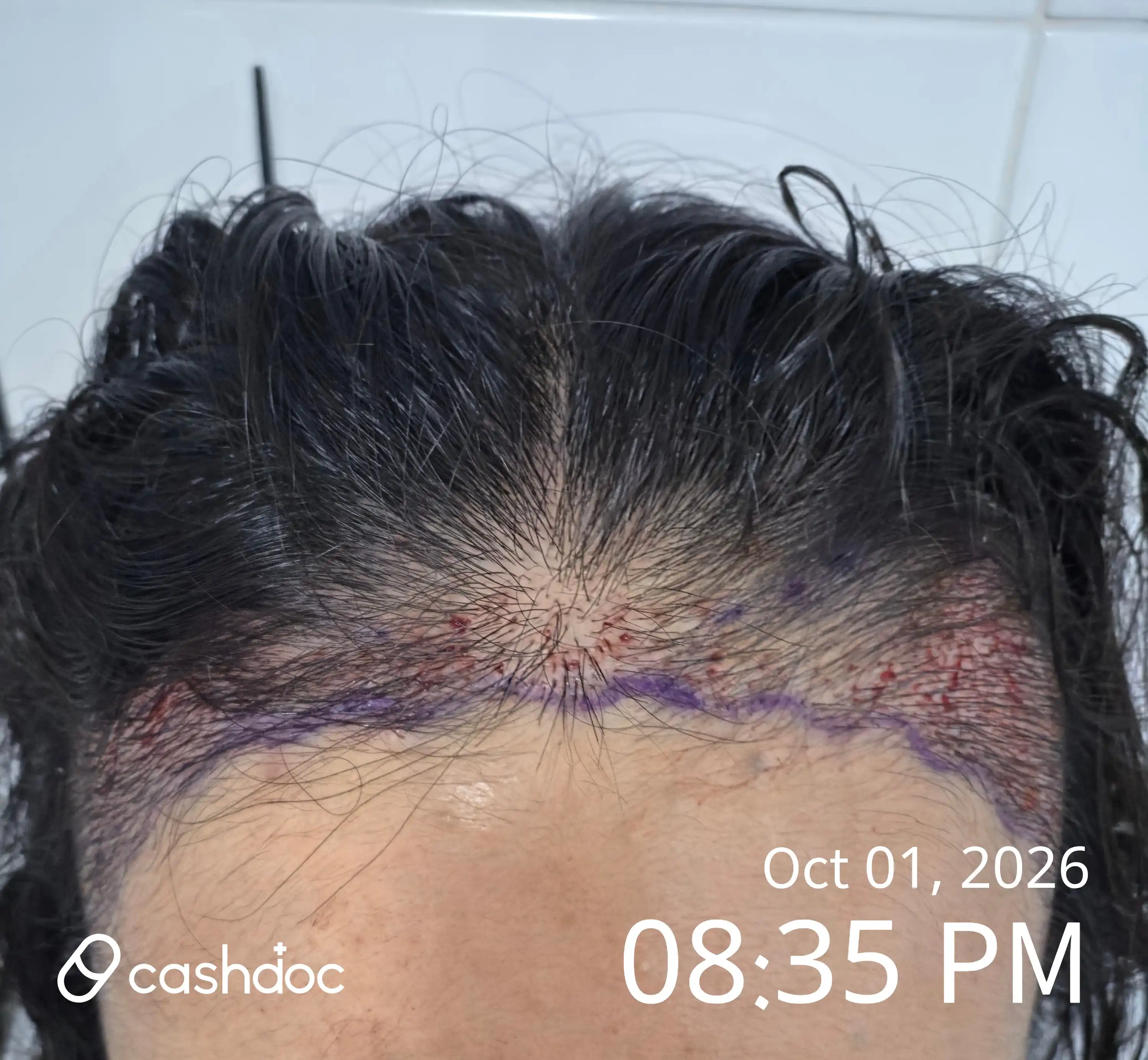 Review photo