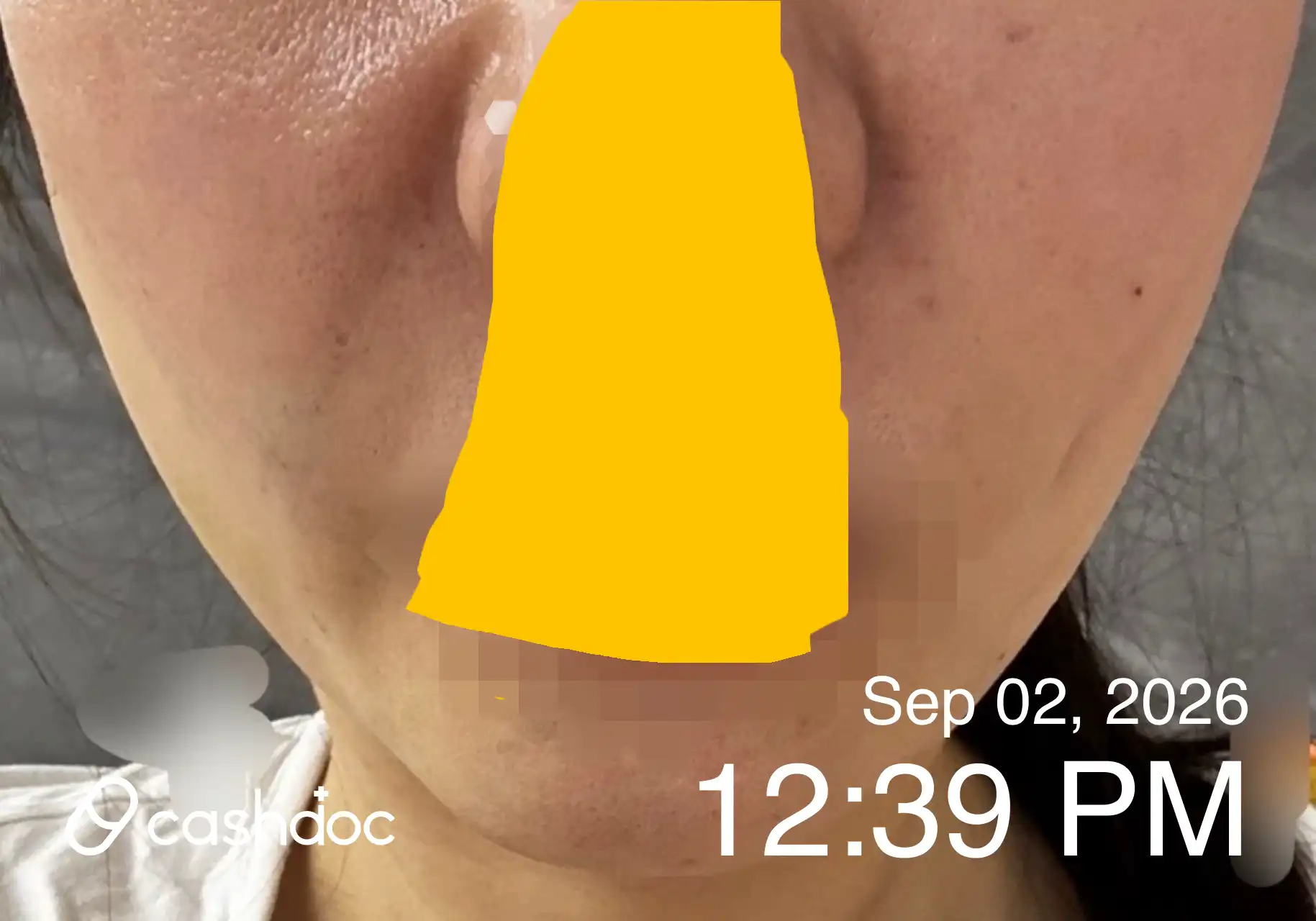 评价照片