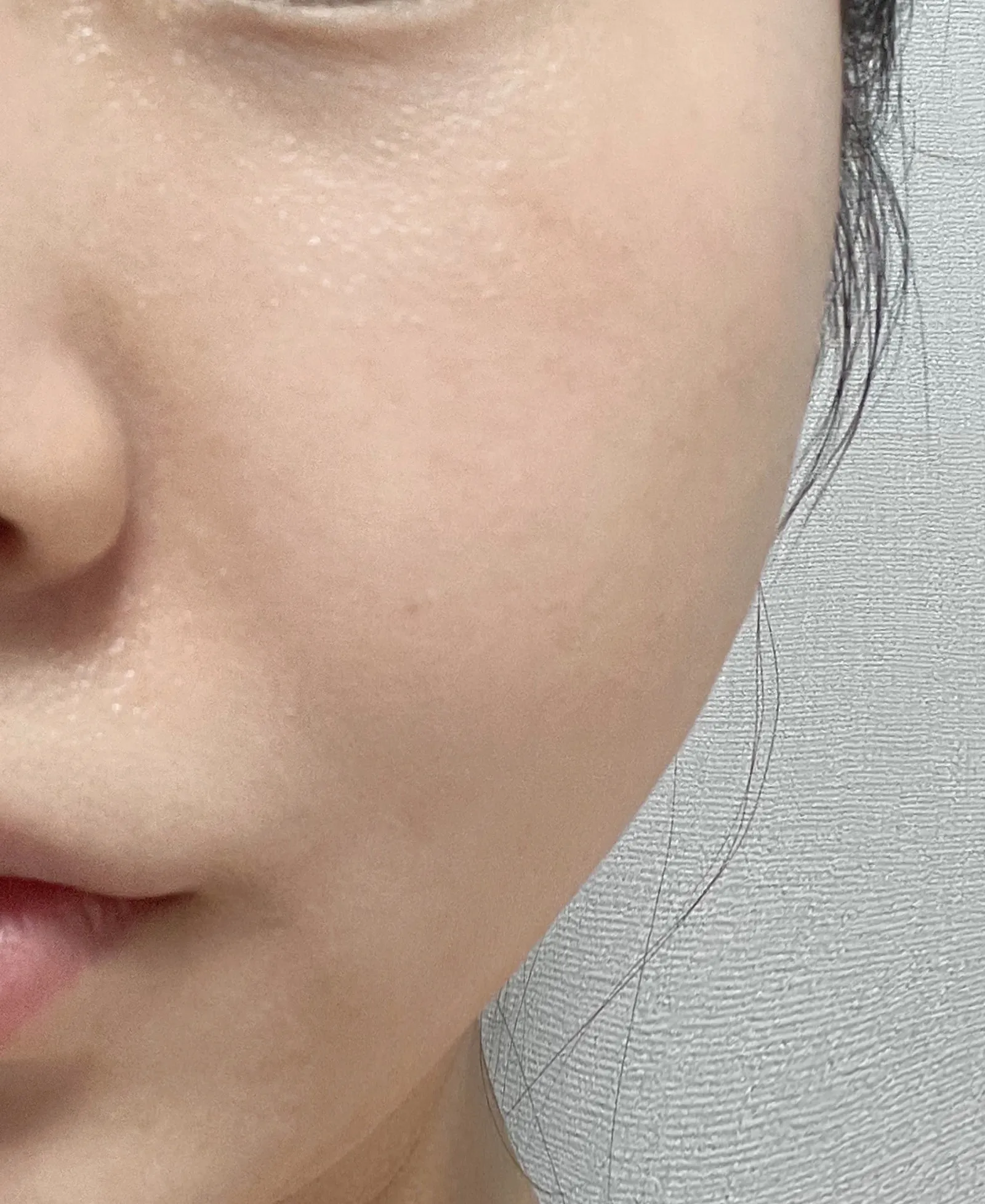 시술 후 — 영등포점_피코토닝 2.5만원