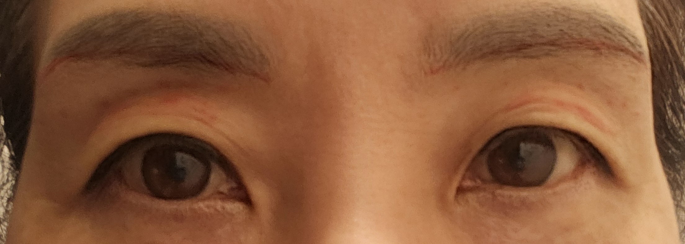 전