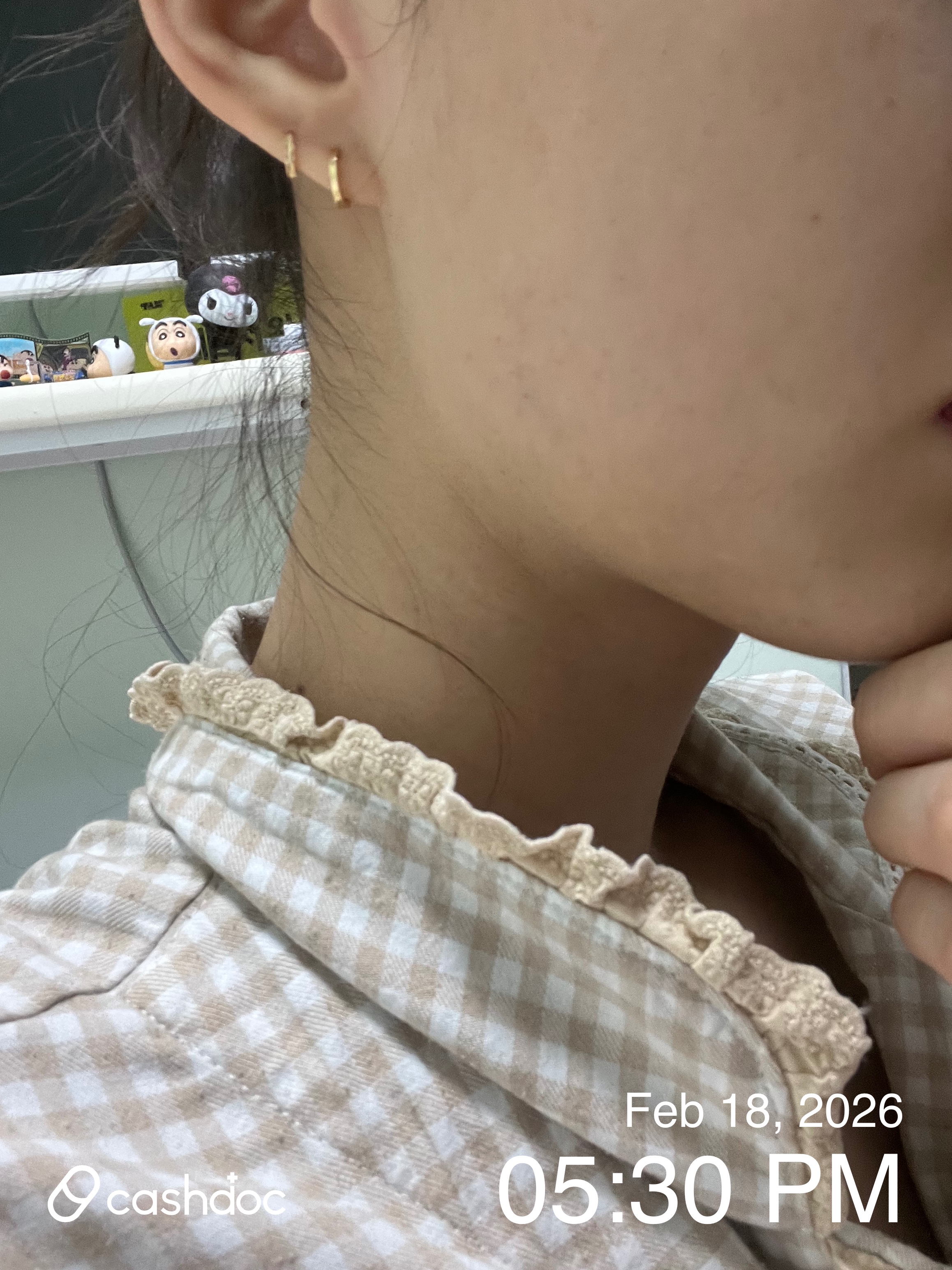 청주 바로그의원, 설 연휴에도 부담 없는 보톡스 가격!