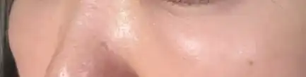 전