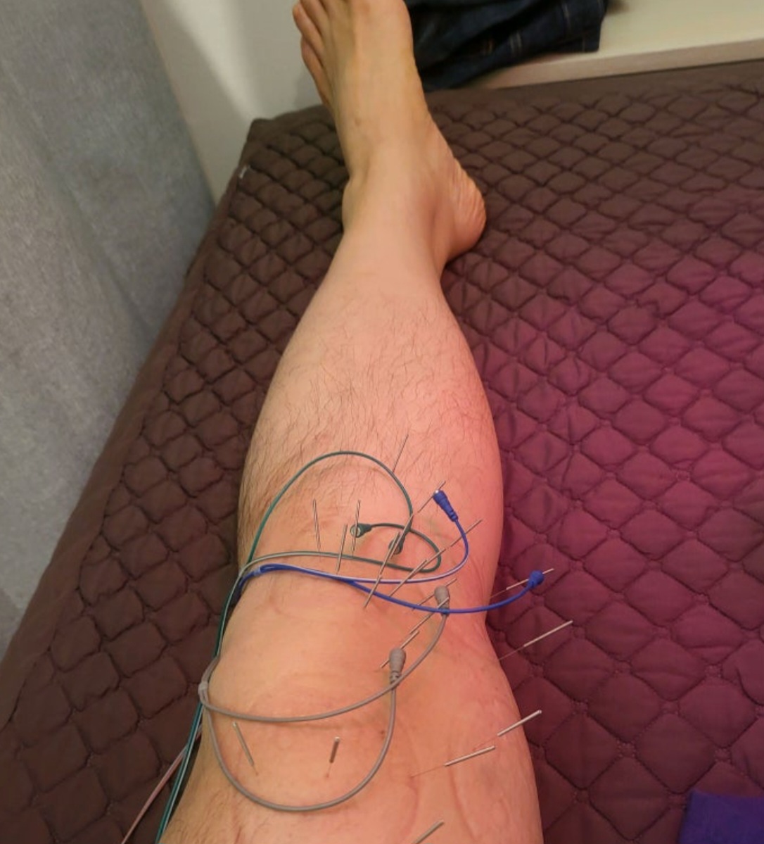 부평구 갈산한의원, 무릎 통증 치료가 인상 깊었어요