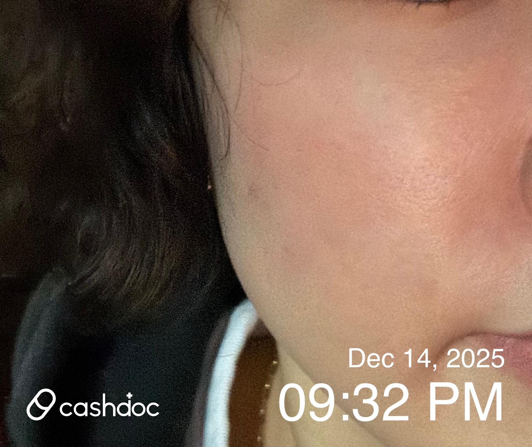 사하구 셀렉트피부과의원에서 피부 진정 효과 탁월해요