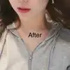 後