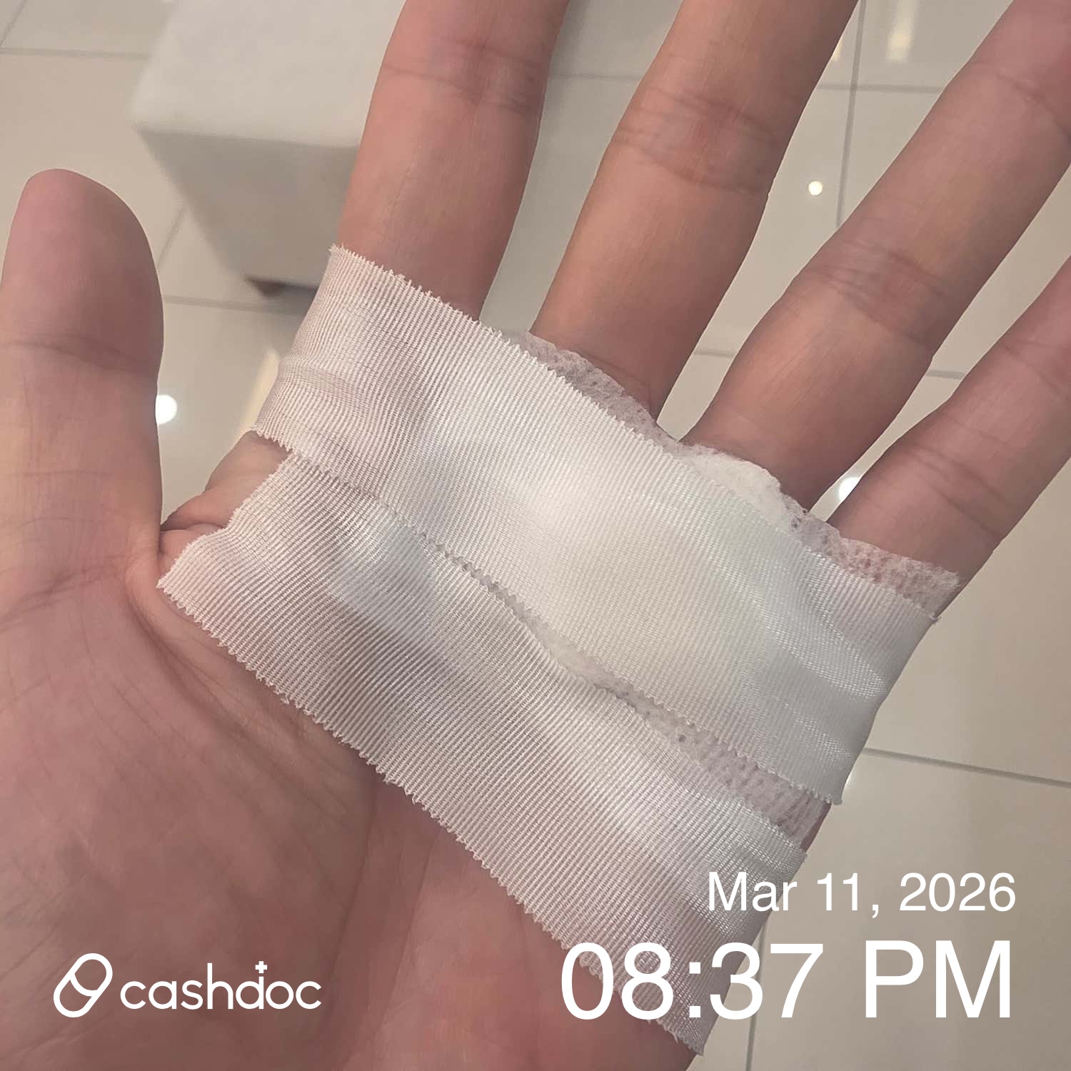 성남시 노블진내과의원에서 손바닥 찢어진 상처 치료 후기