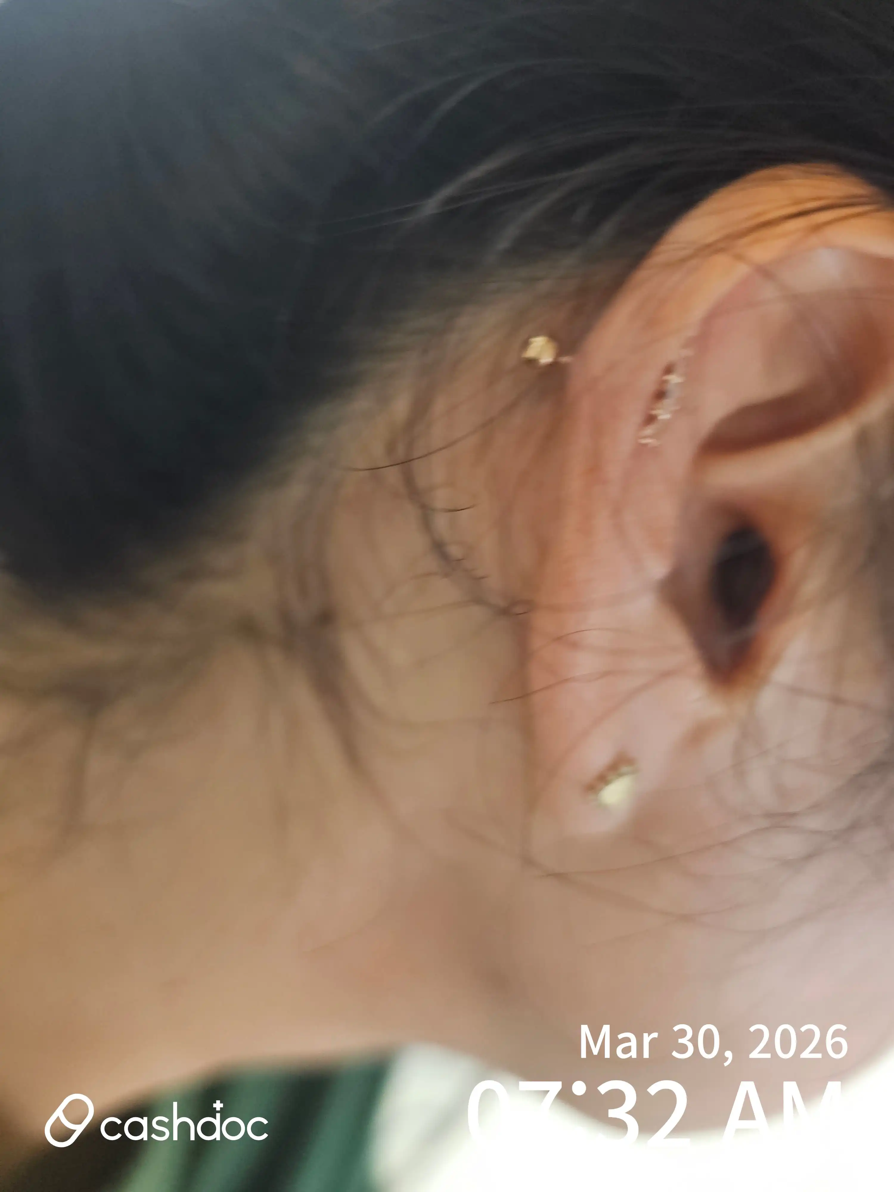 Review photo