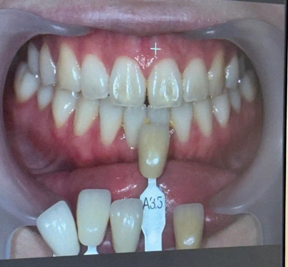 Review photo