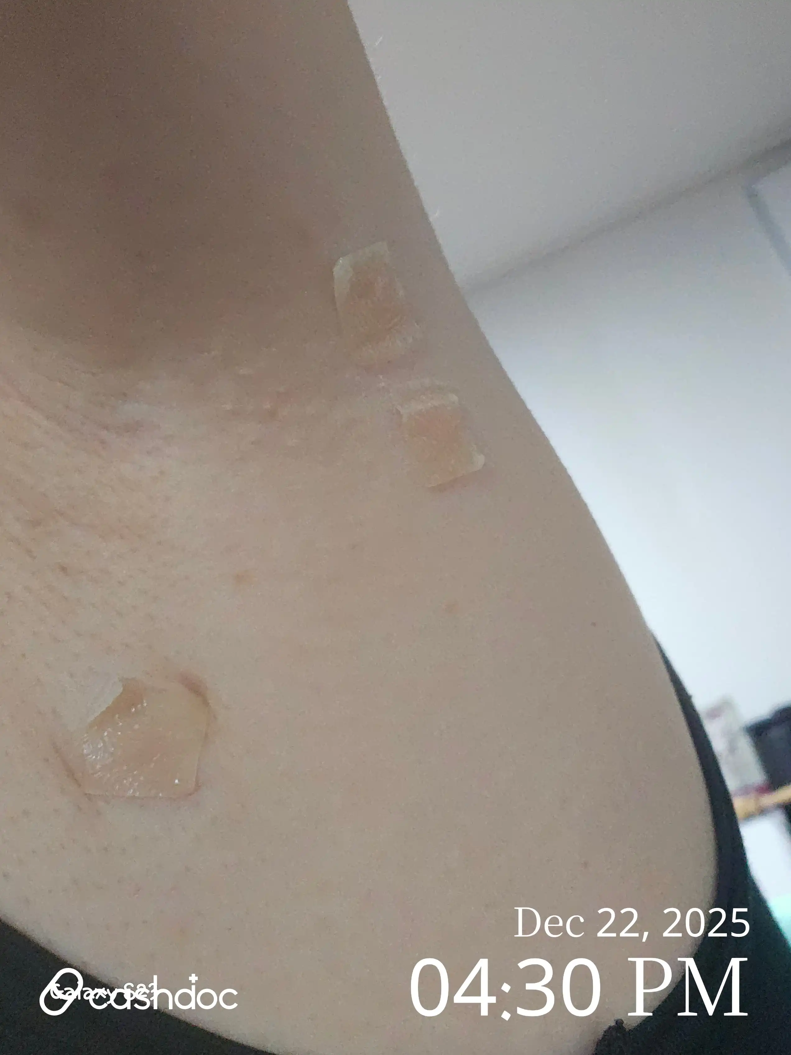 评价照片