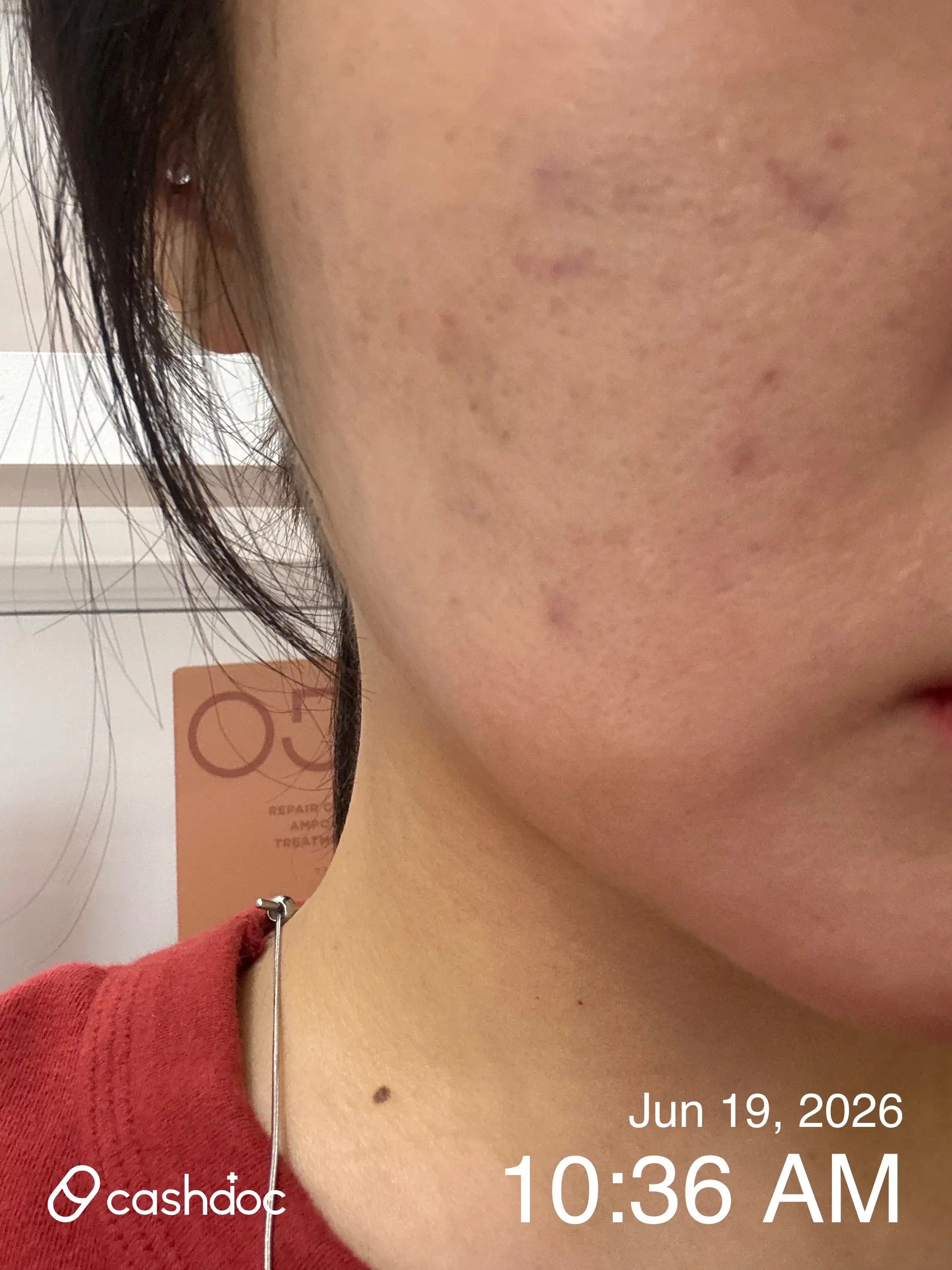 Review photo