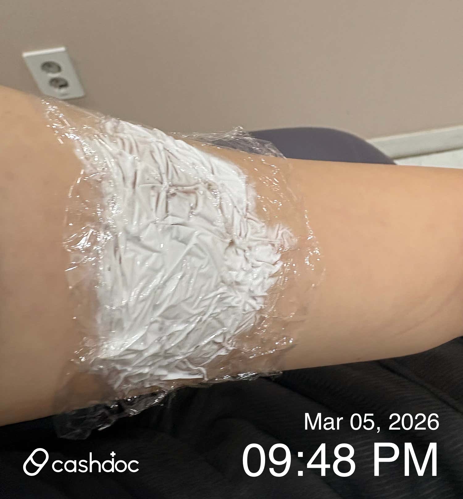 강남구 차이성형외과의원에서 문신 제거 결과에 만족해요!