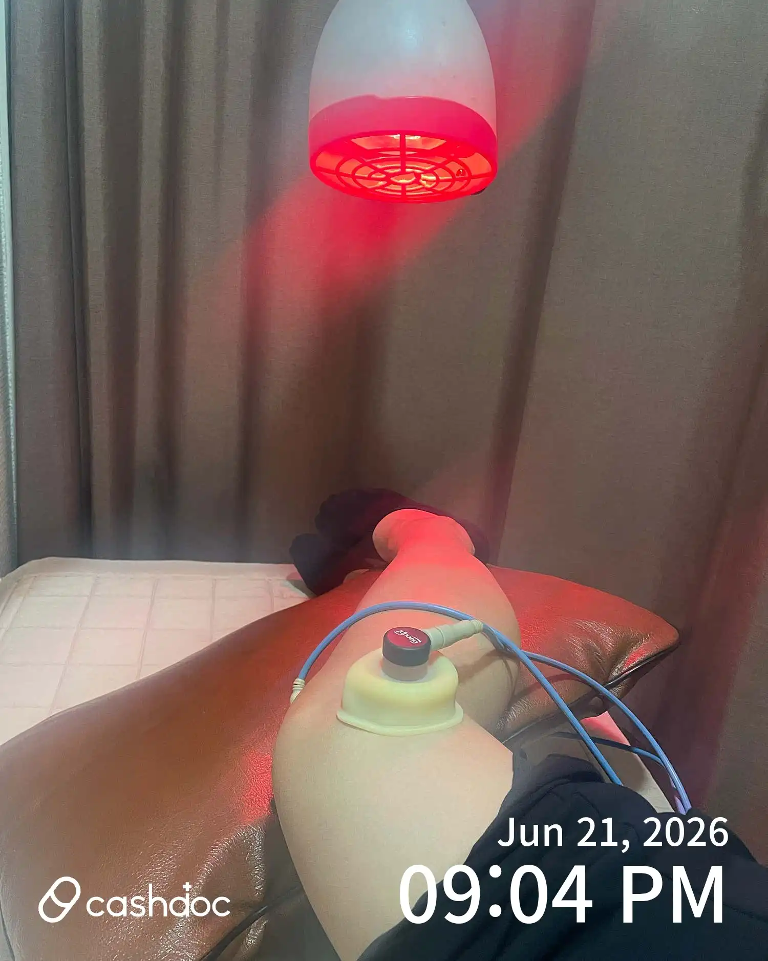Review photo