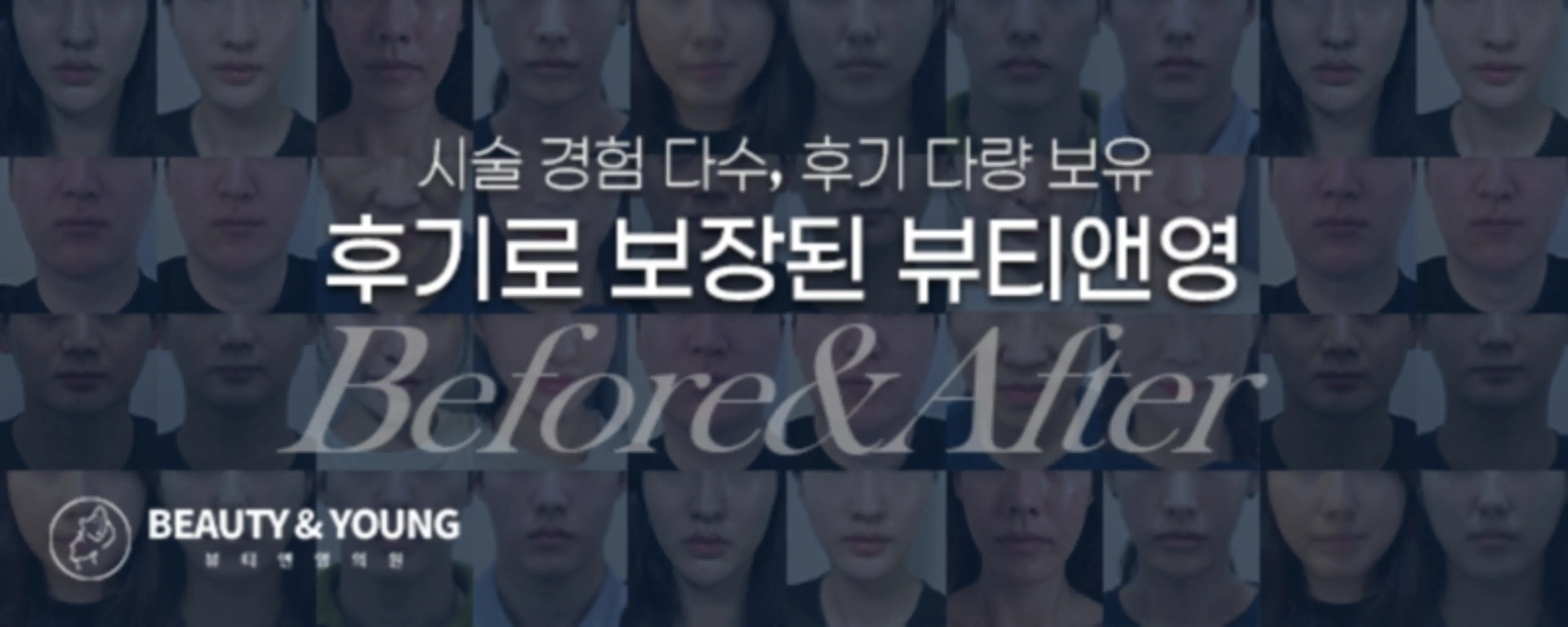 뷰티앤영의원 - 7