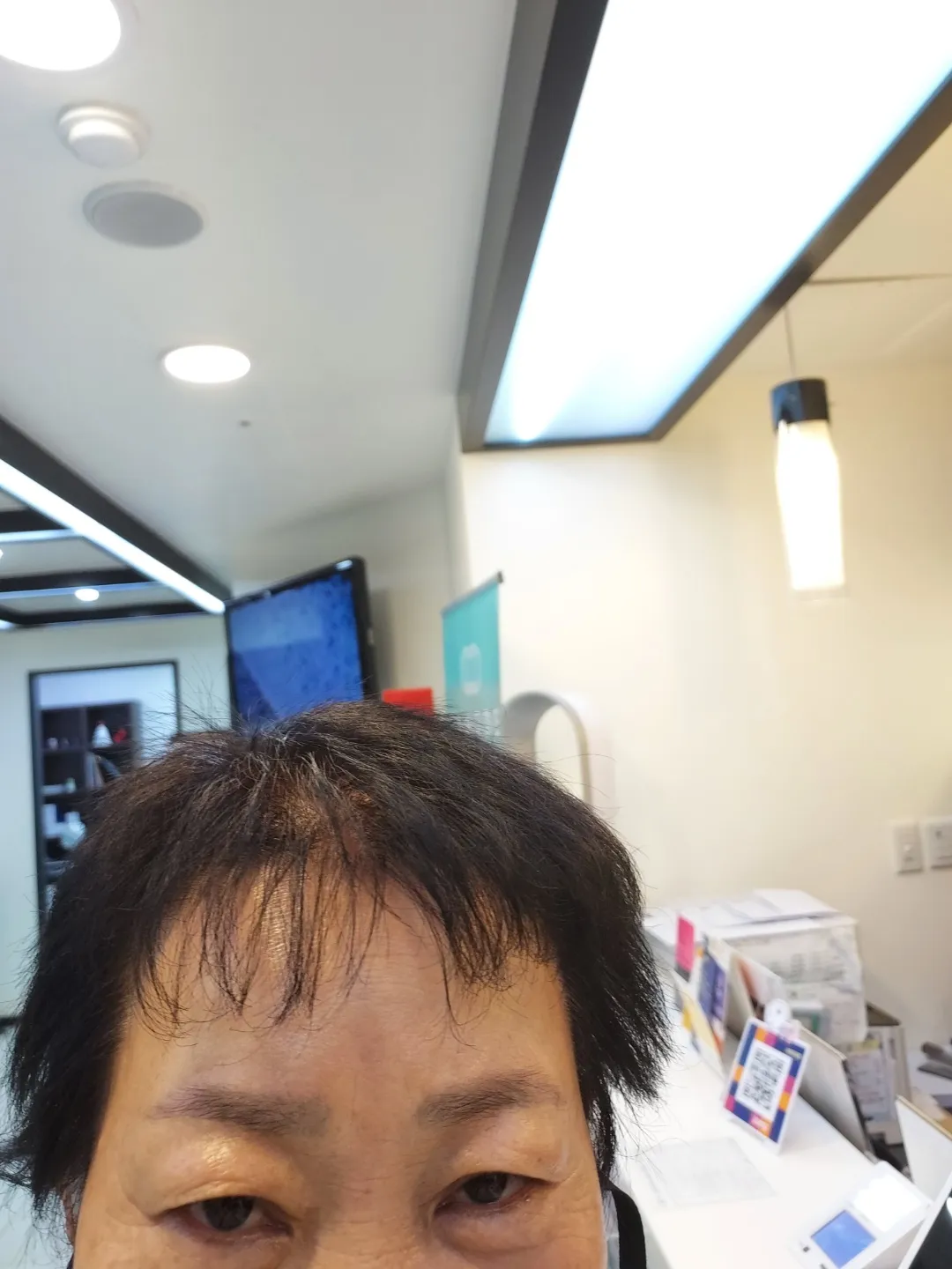시술 전 — 	번지지않는 아이라인반영구	