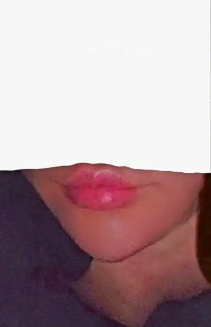 후