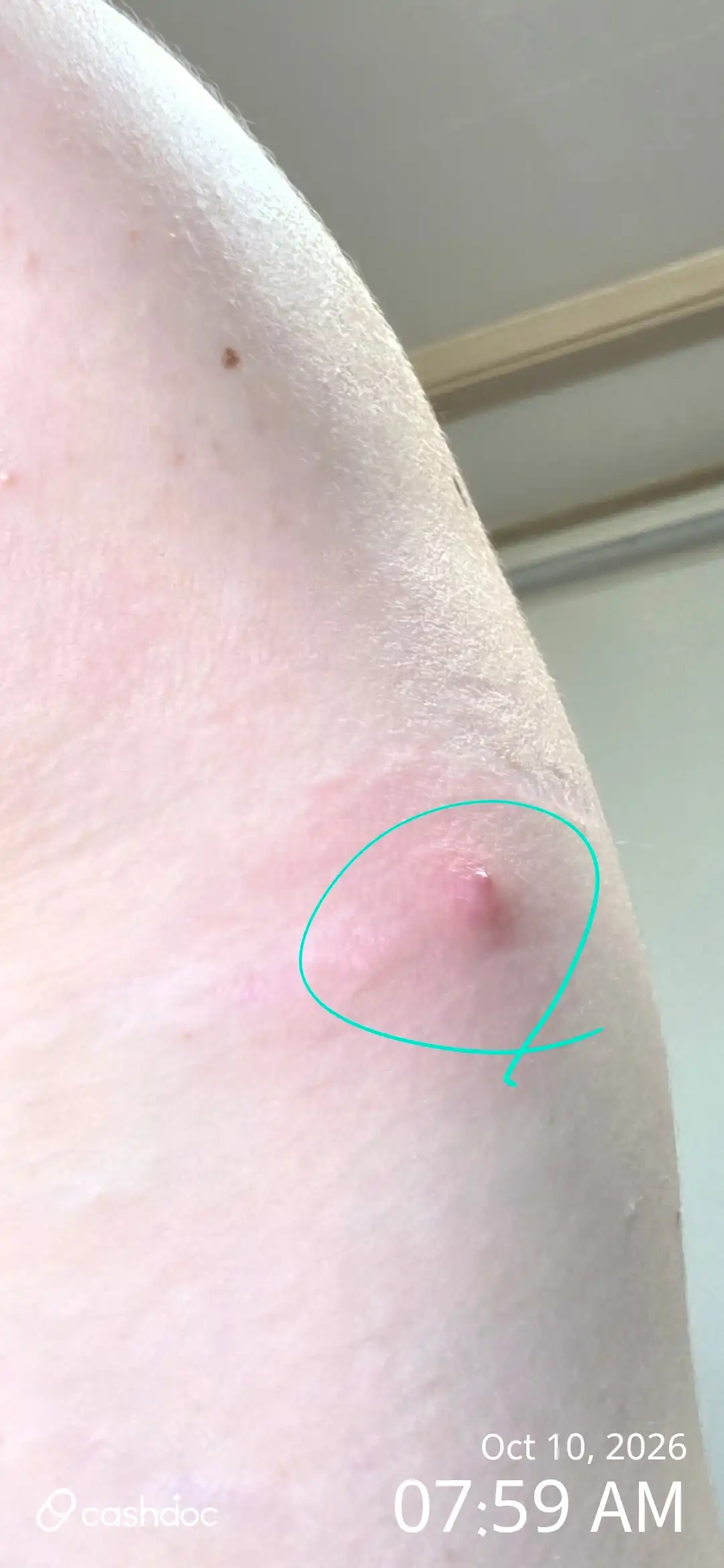 온유항외과의원 후기 사진