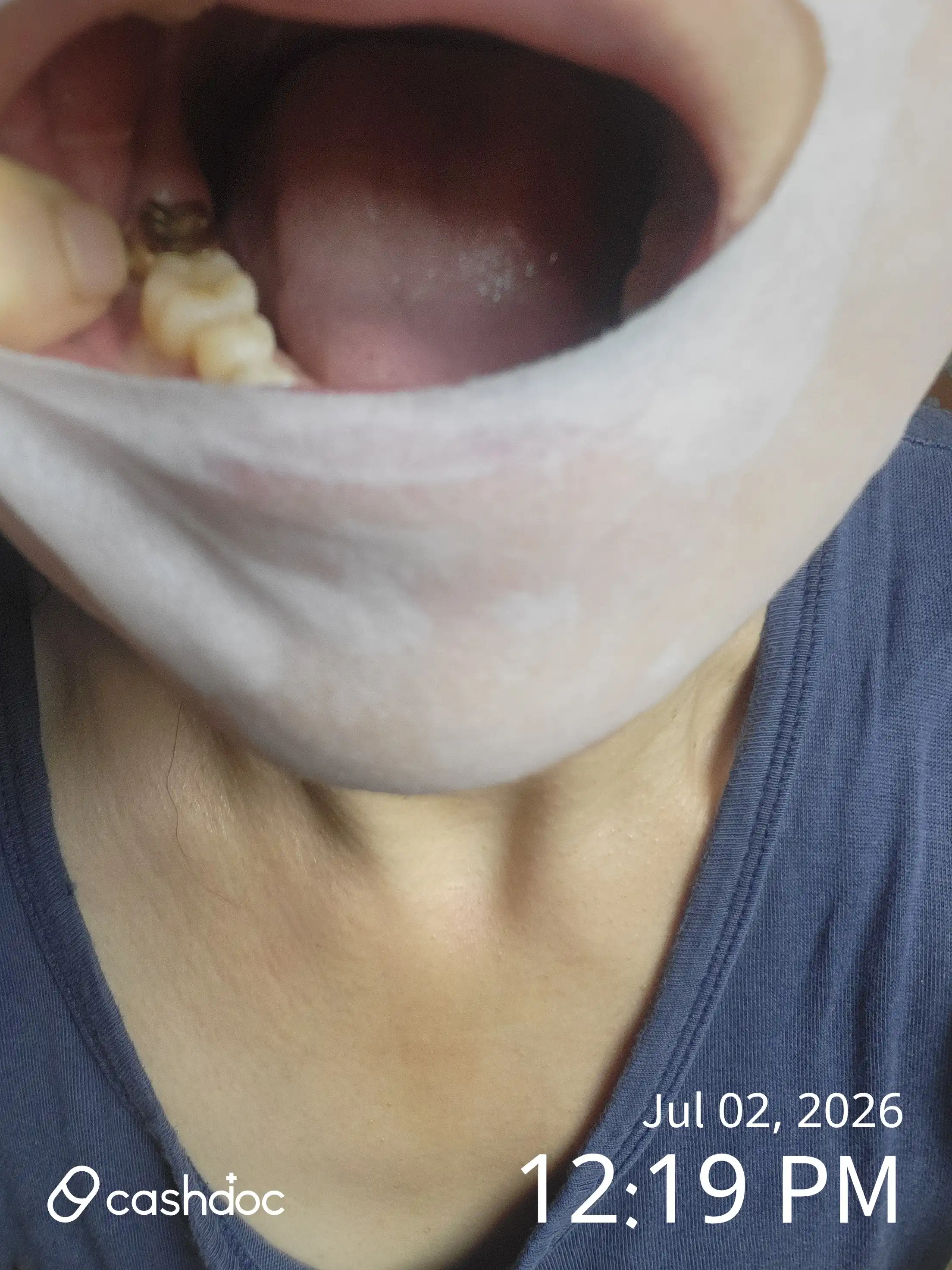 Review photo