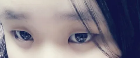 시술 전 — 플래너만의 멍뭉트임♥