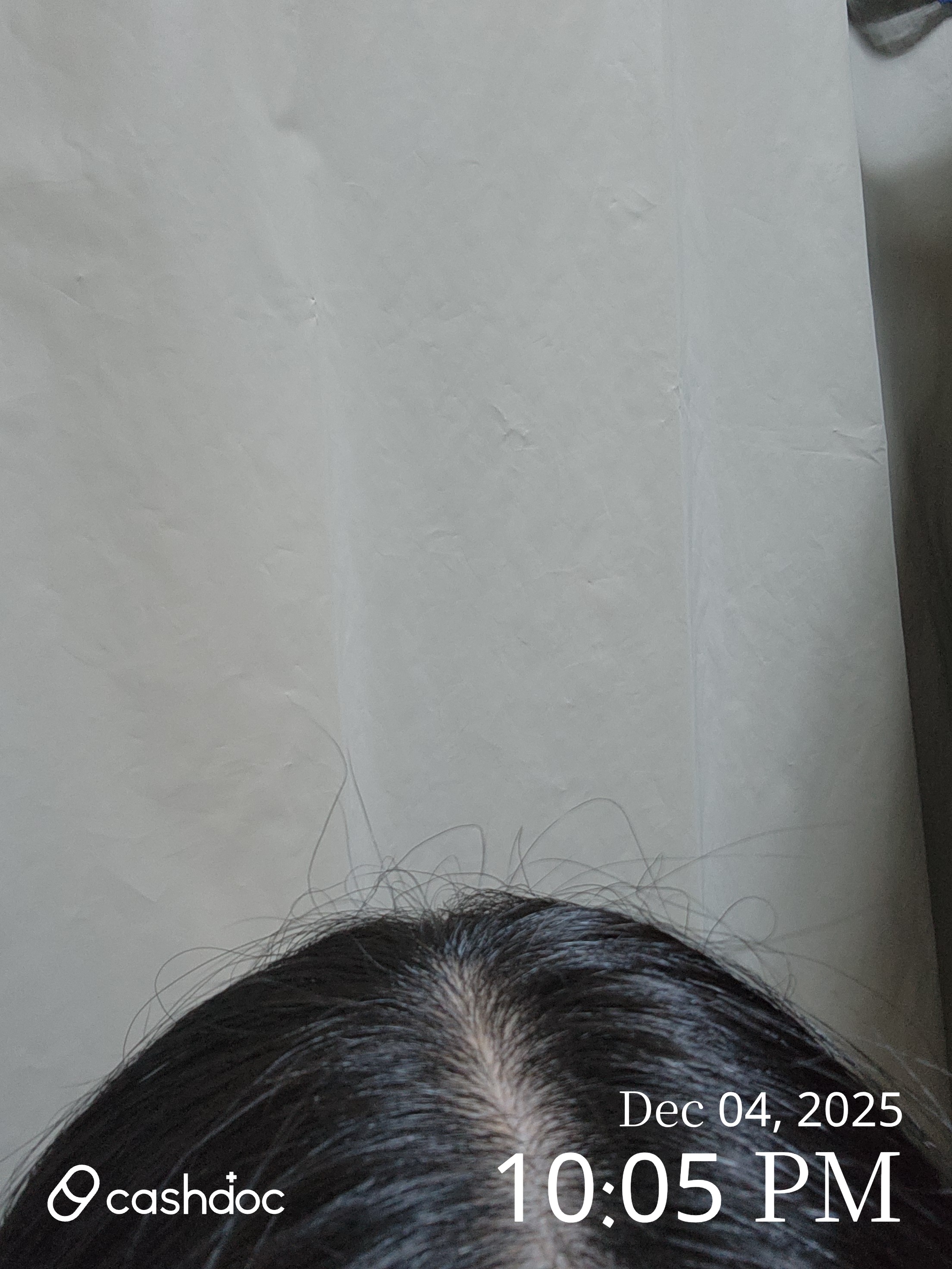 충청남도 전피부과의원에서 두피 문제, 마침내 해결받다