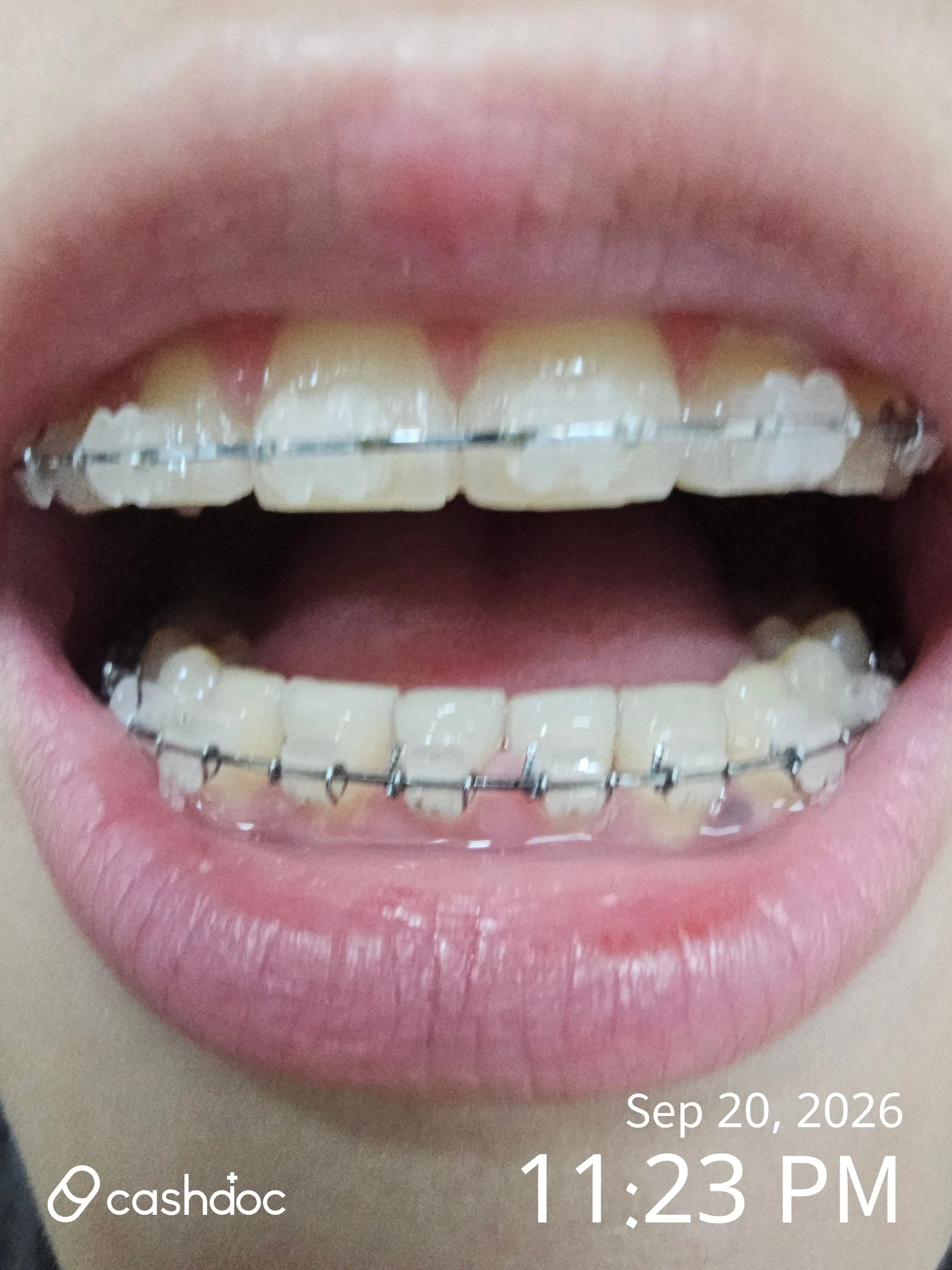 Review photo
