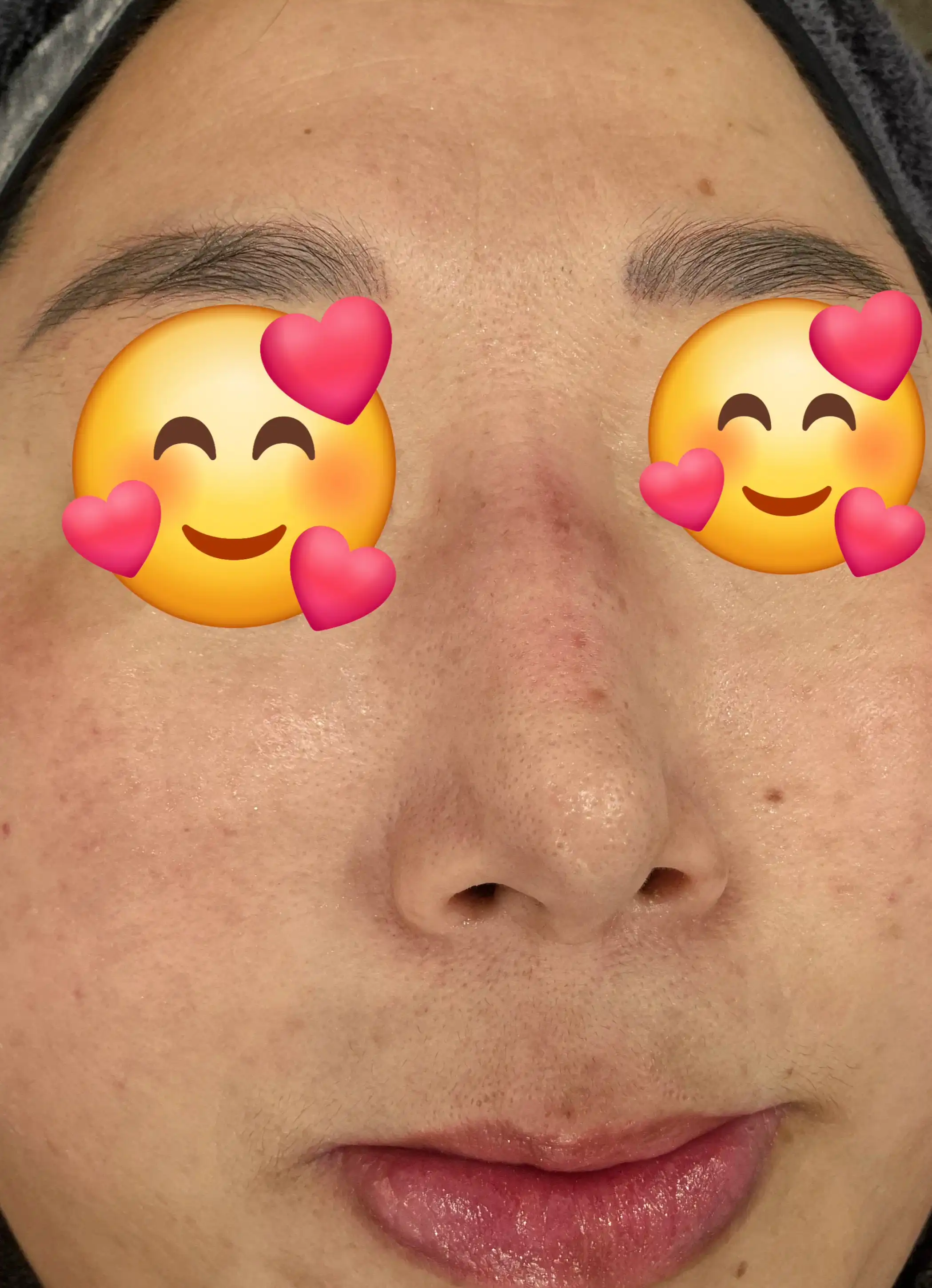전