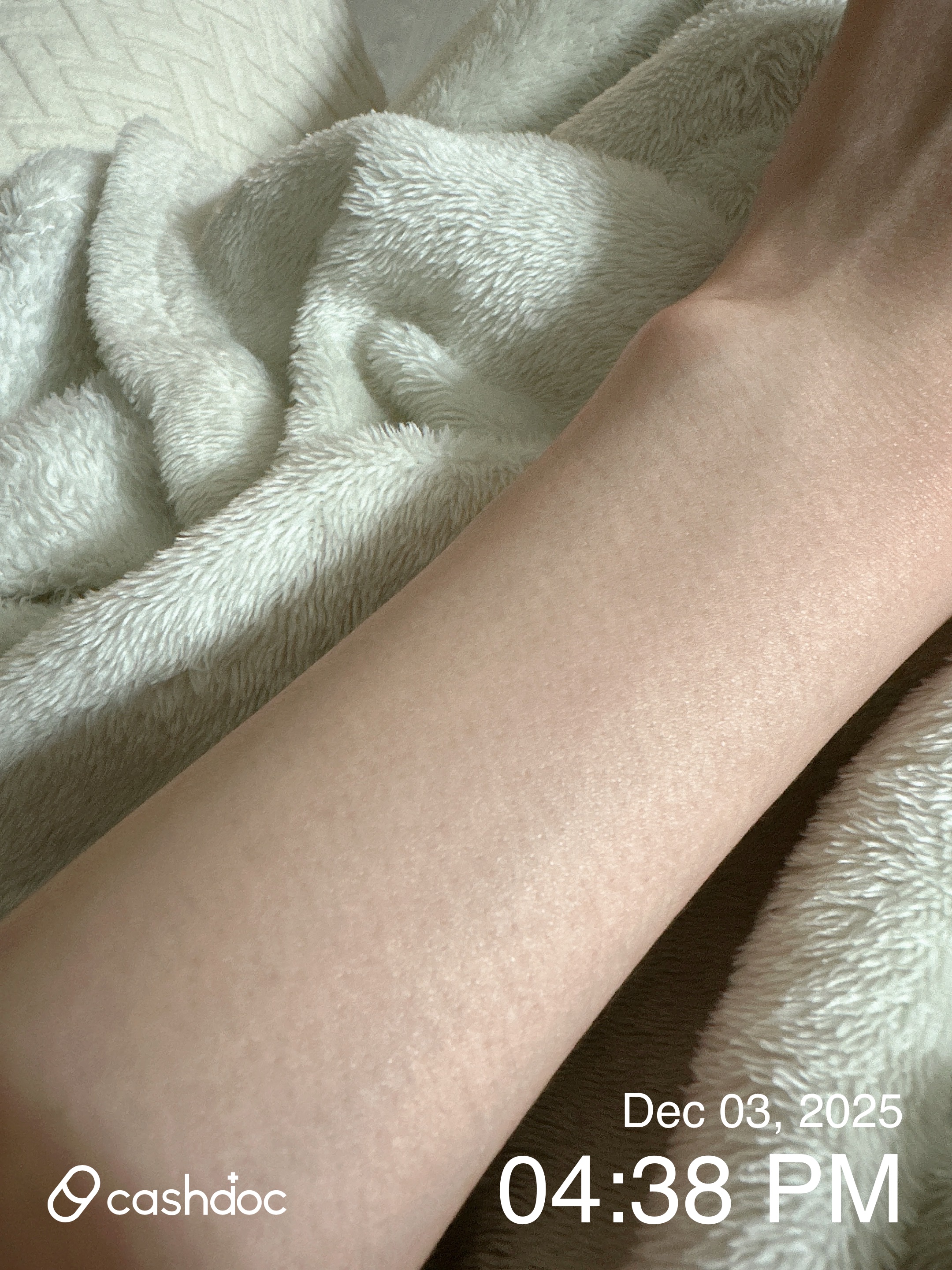 서울 천호 애플산부인과의원, 꼼꼼한 레이저 제모 후기