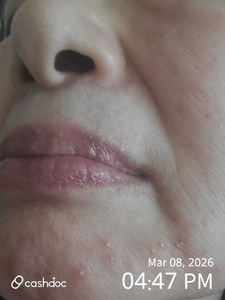 제주시 연세피부과의원에서 잘못된 처방 바로잡아줘