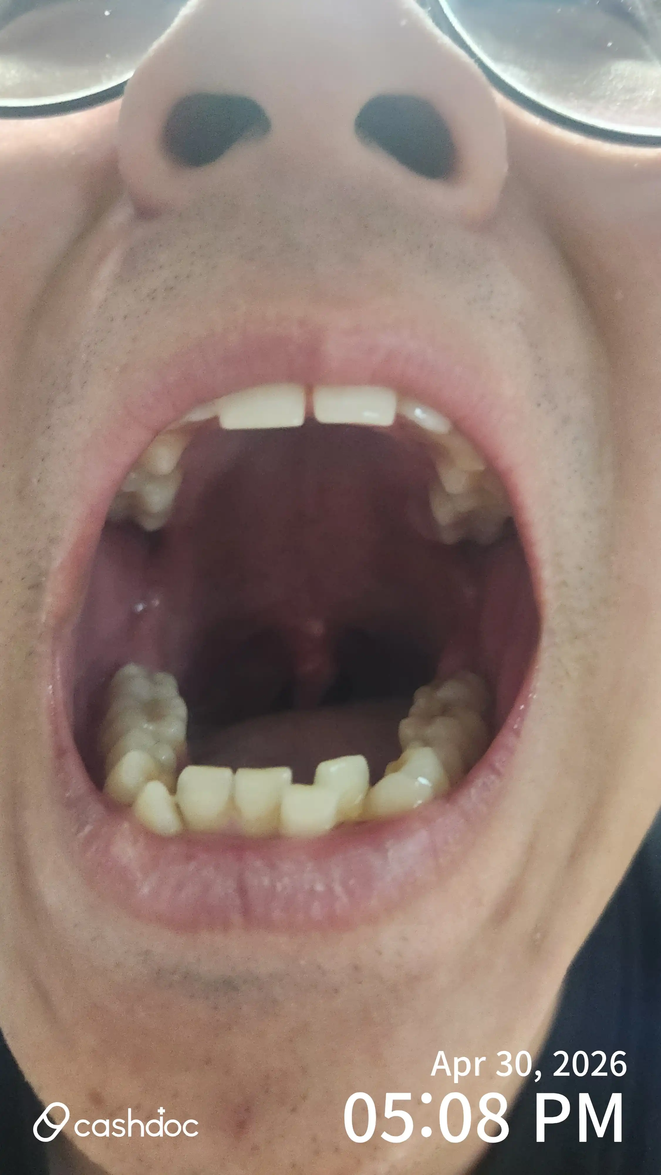 Review photo