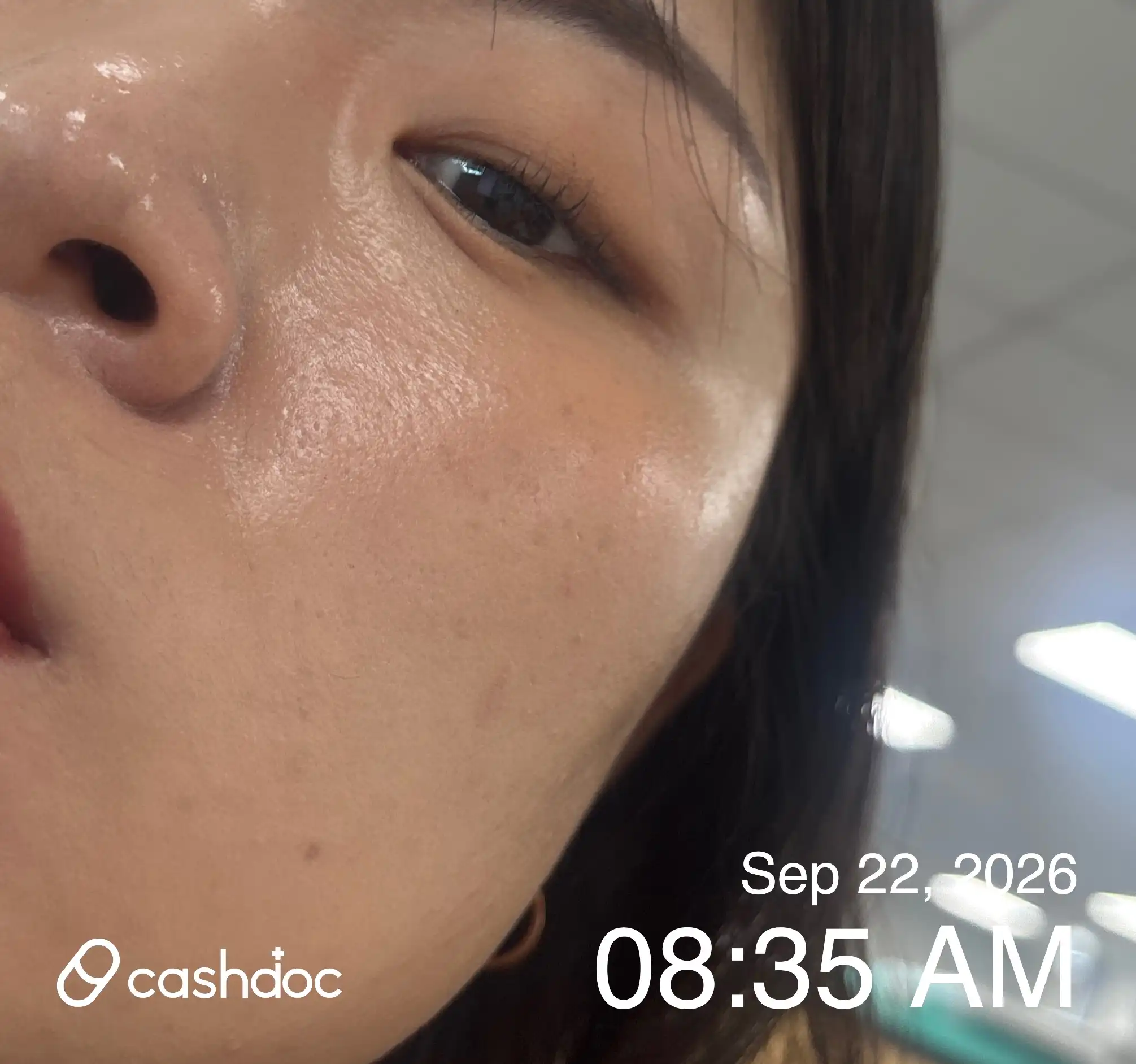 Review photo