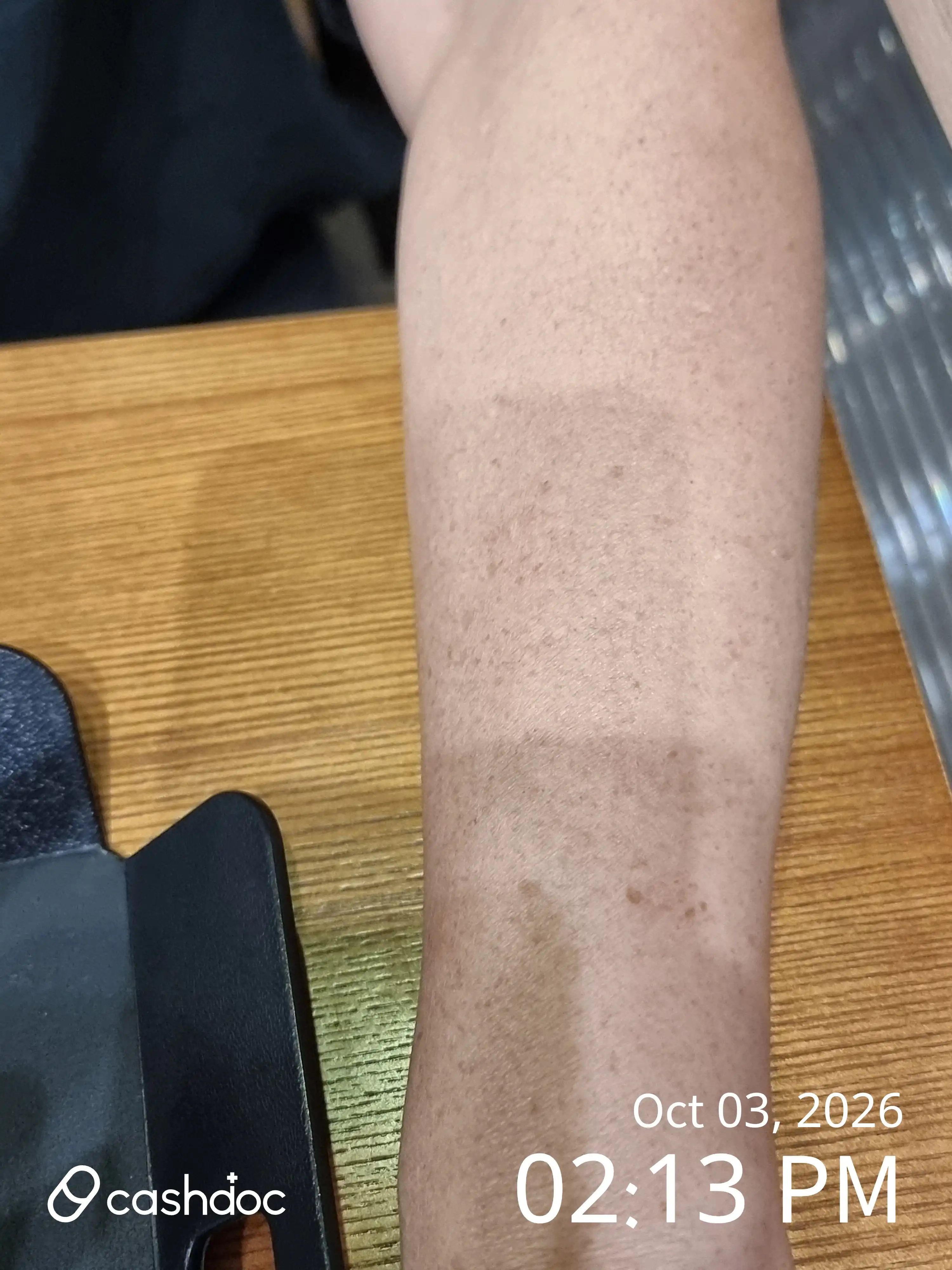 Joeun Dermatology Clinic review photo