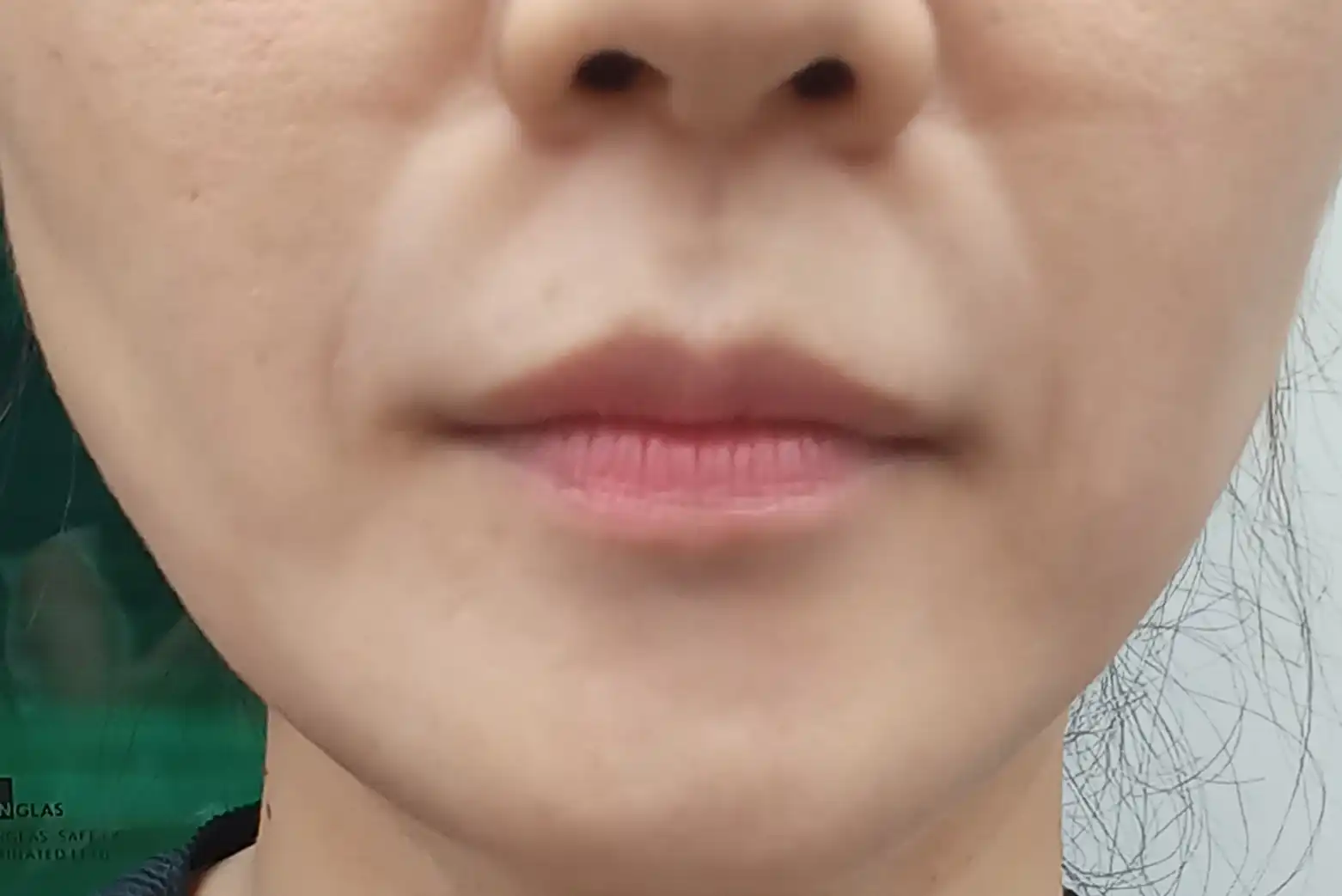 후