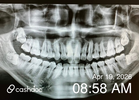 동구 고운니치과의원, 충치 치료 만족스러워요