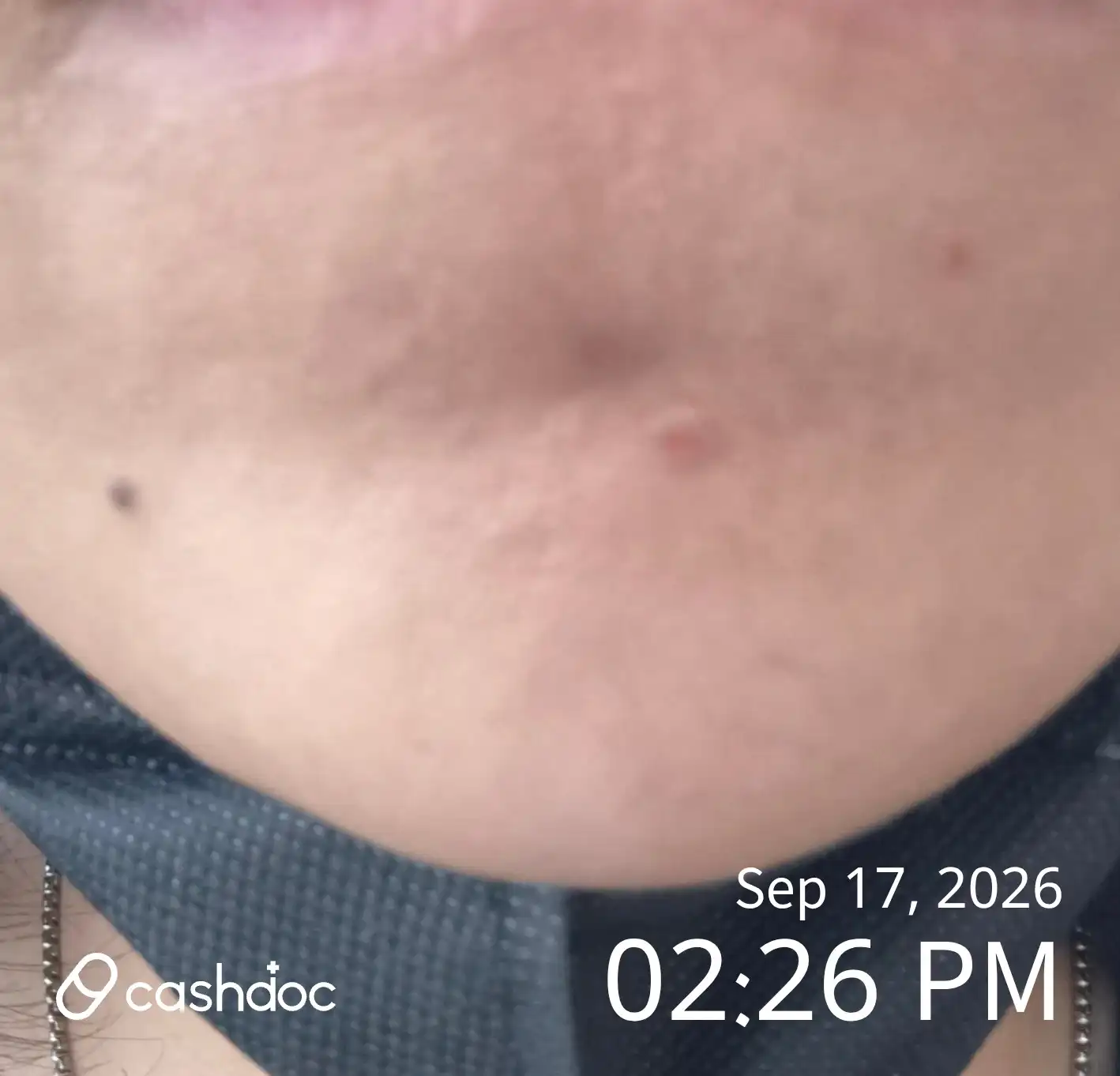Review photo