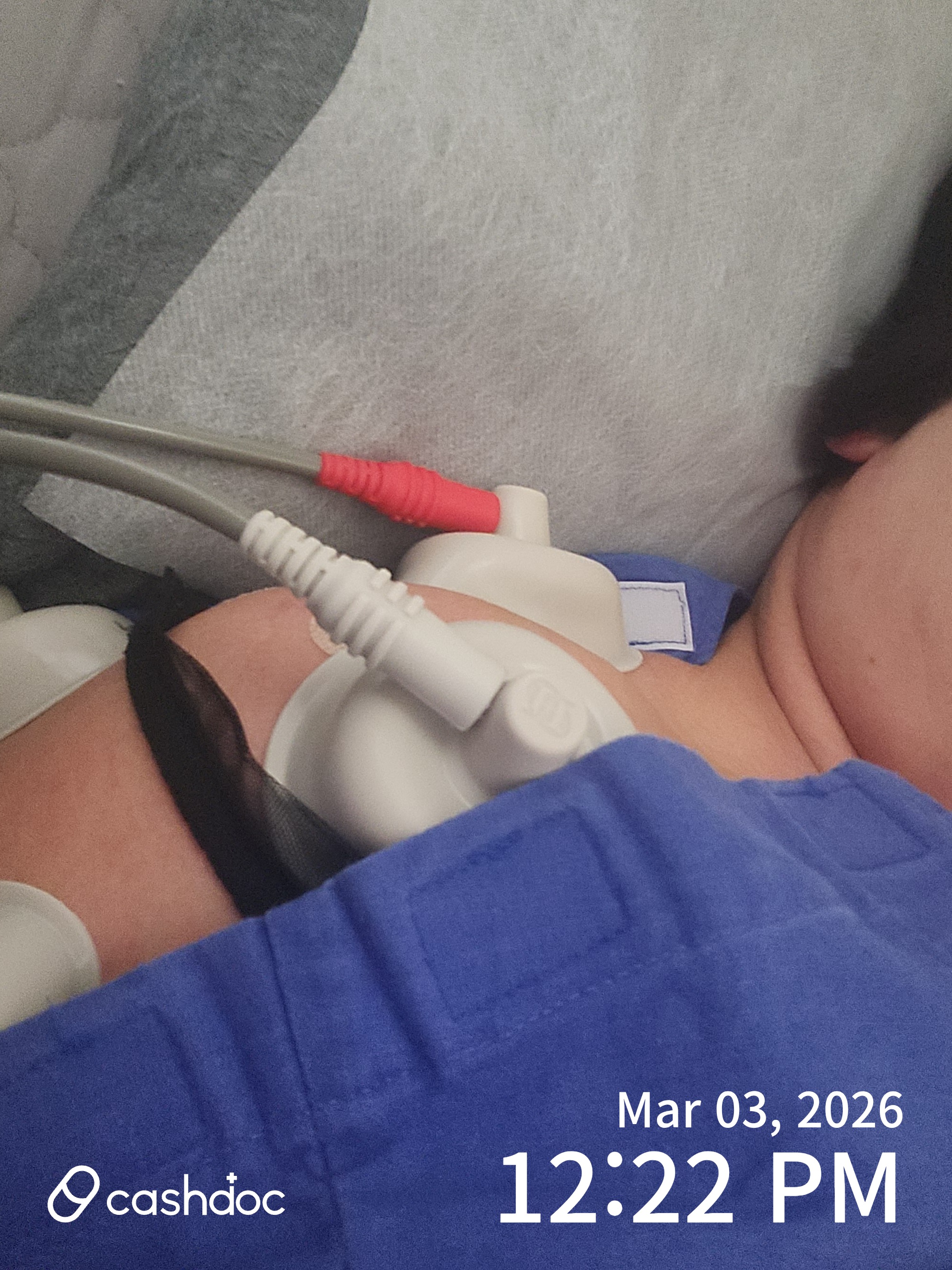 부천본정형외과의원에서 통증 관리와 석회 제거 조언 받아