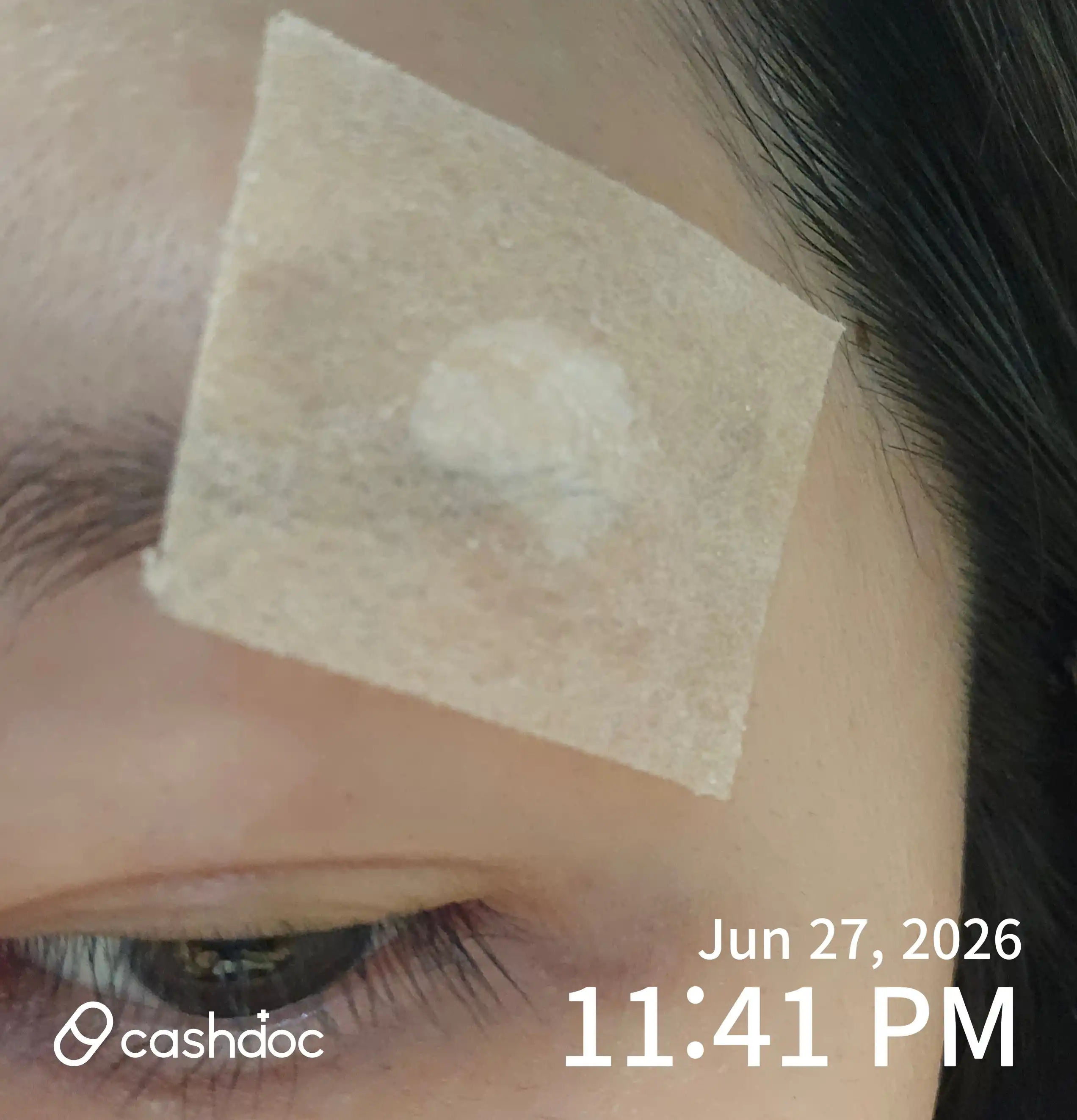 Review photo