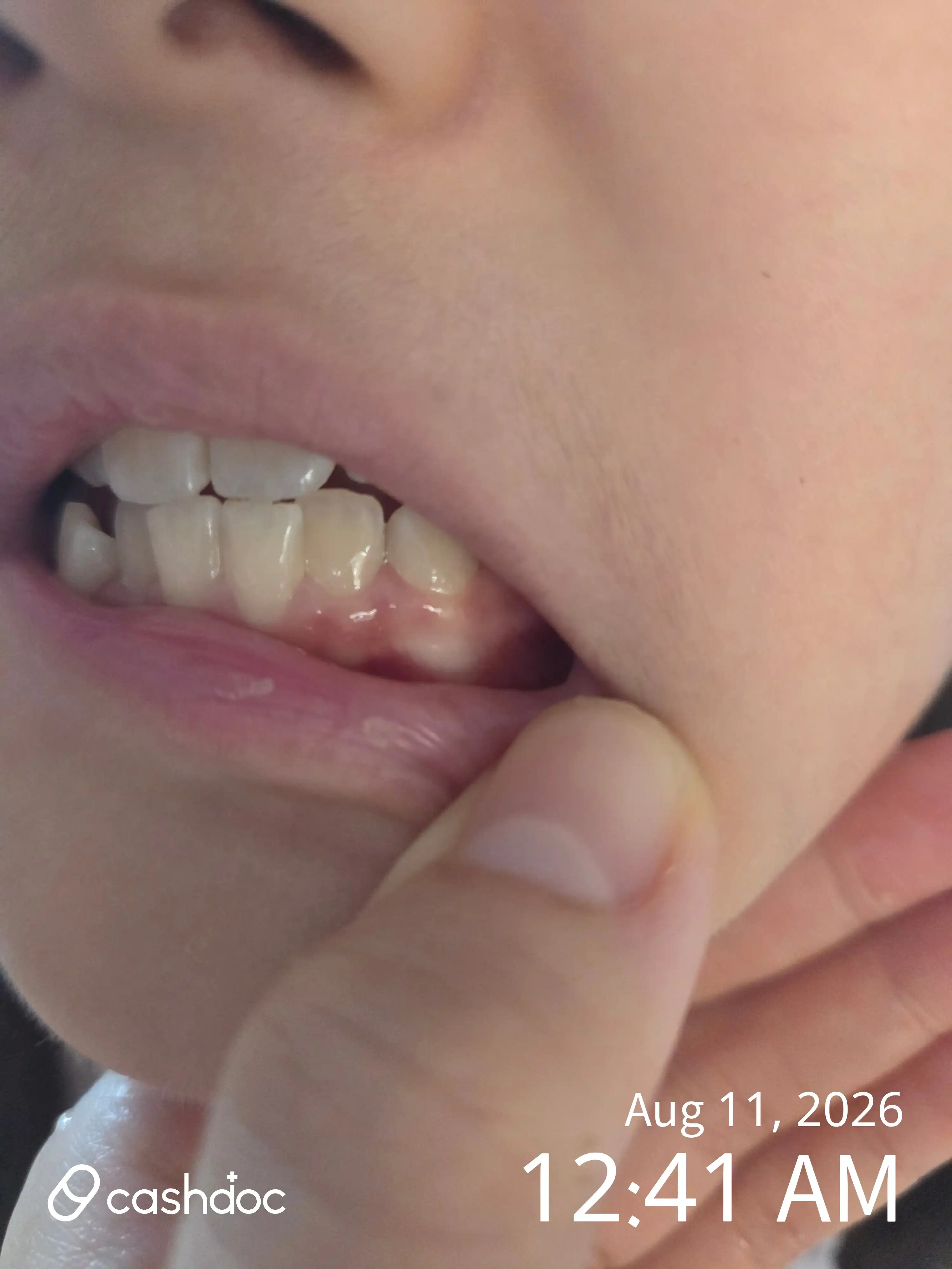 Review photo