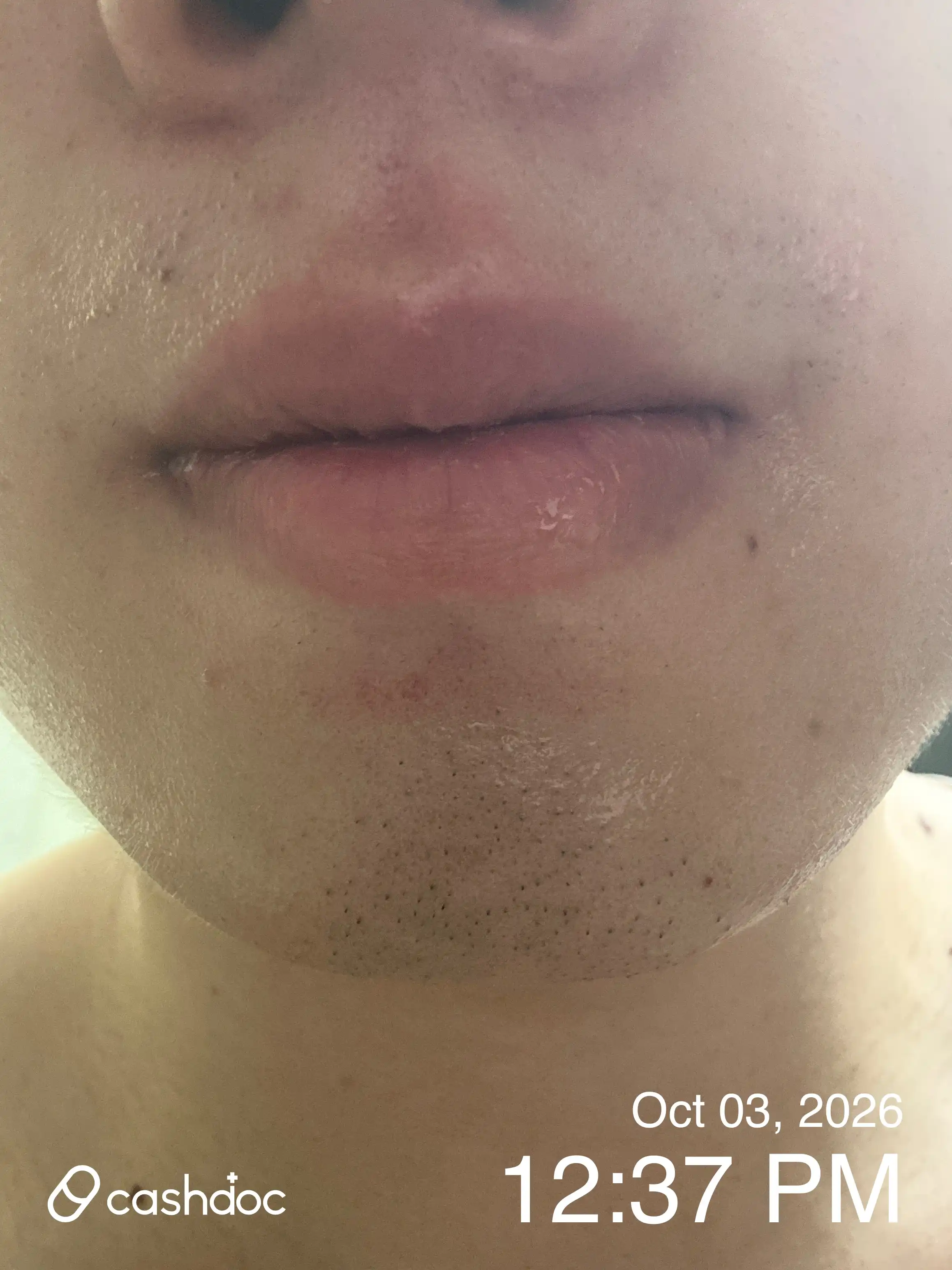 Review photo
