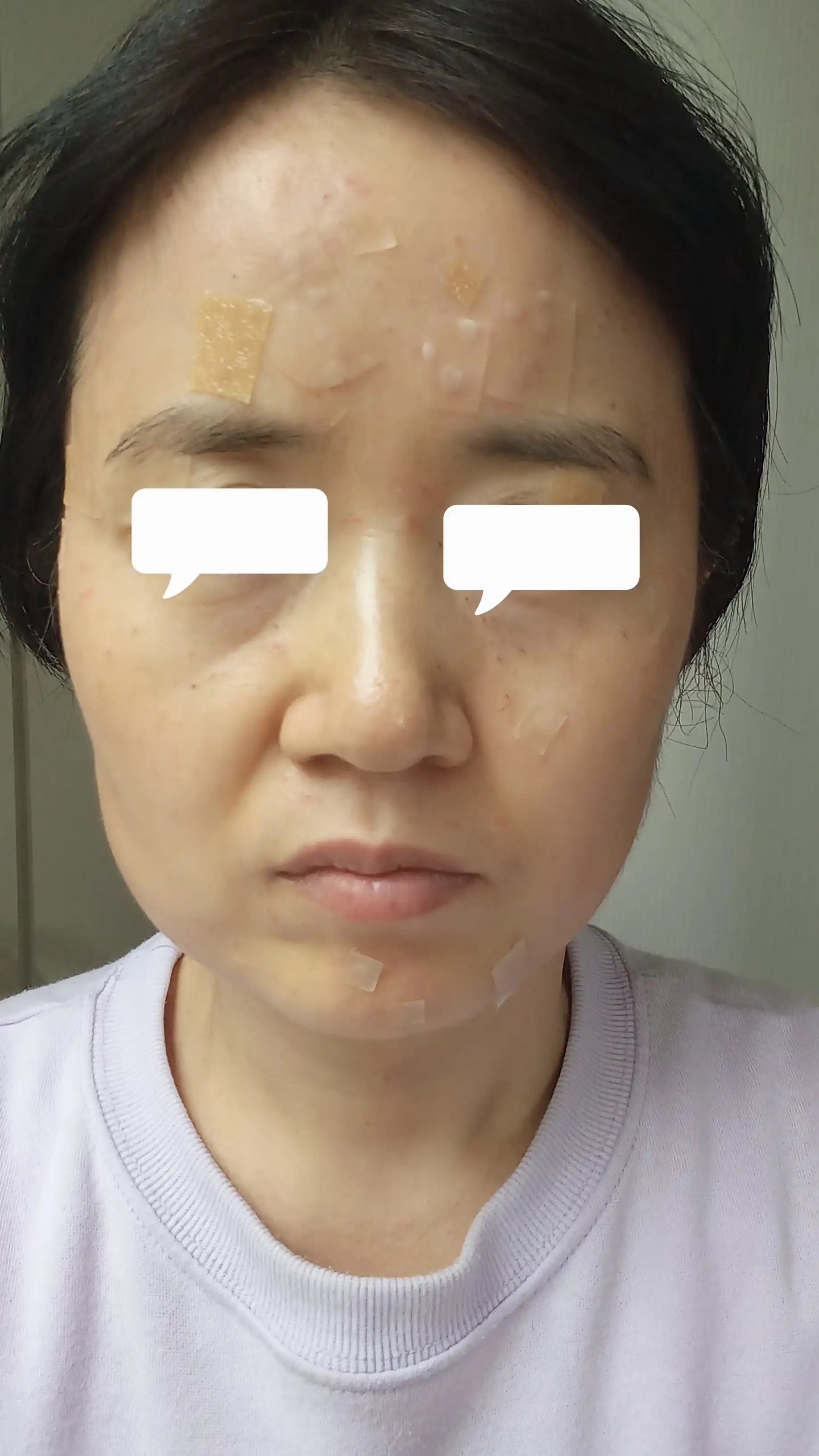 후