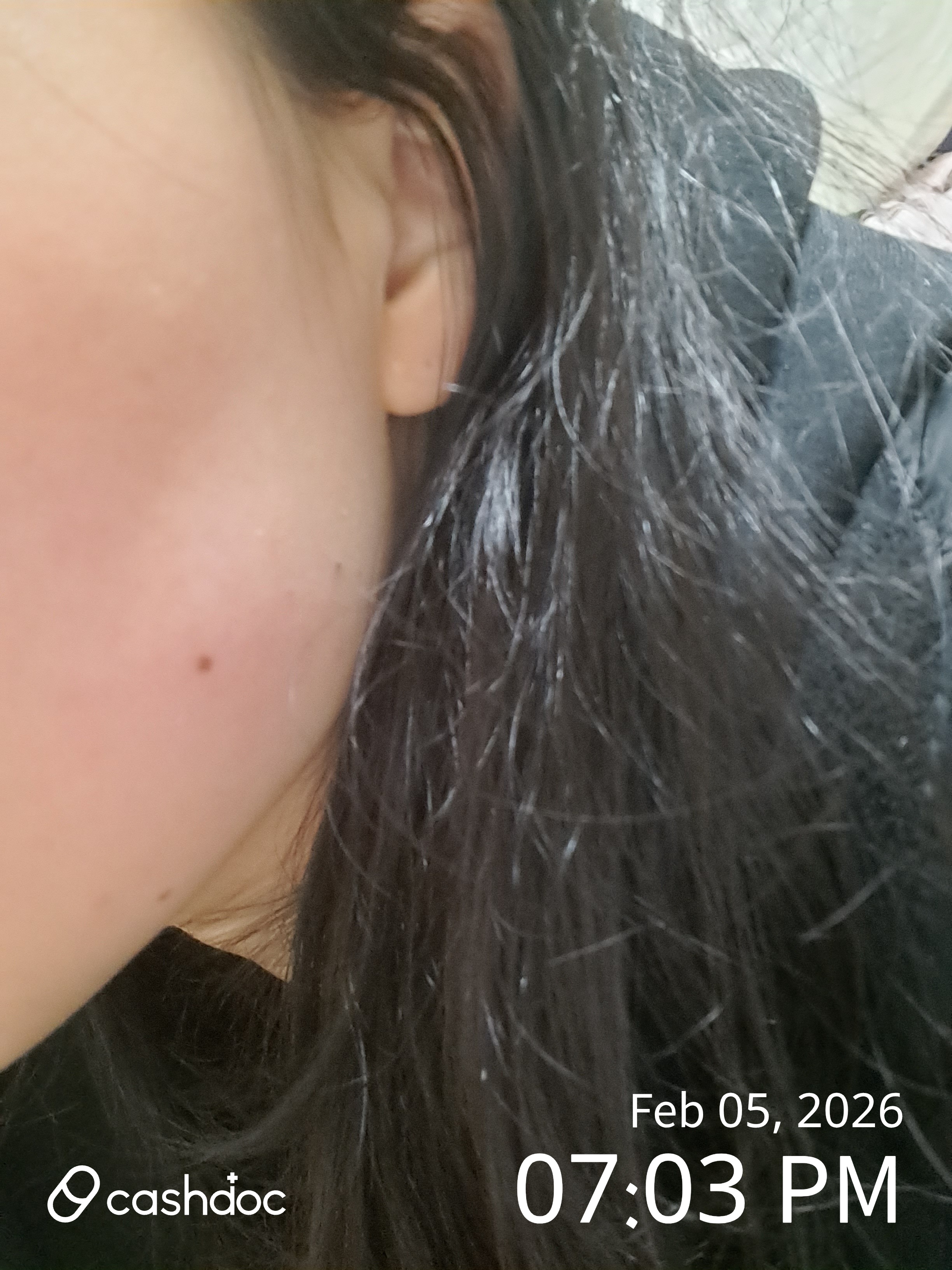 군포시 메이퓨어의원 산본점, 보톡스 경험이 친절했어요