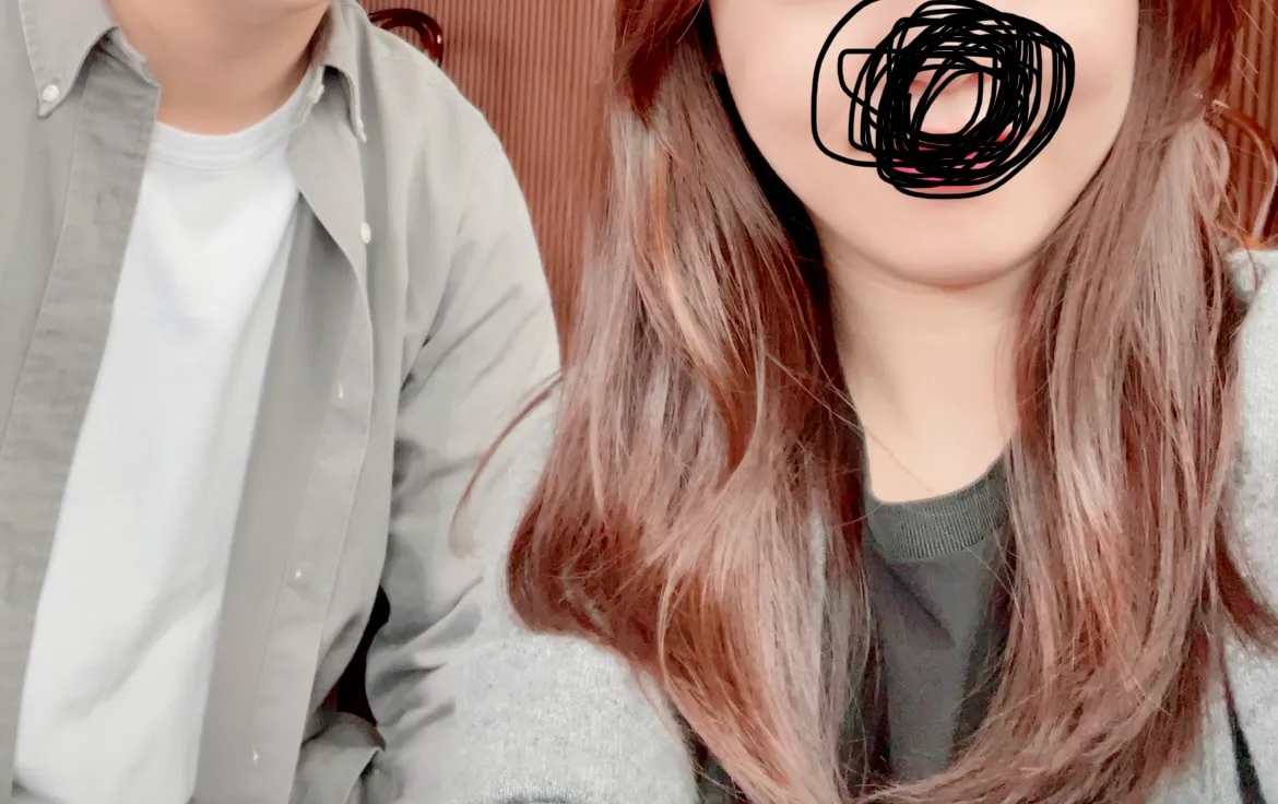 시술 전 — 인모드 리프팅