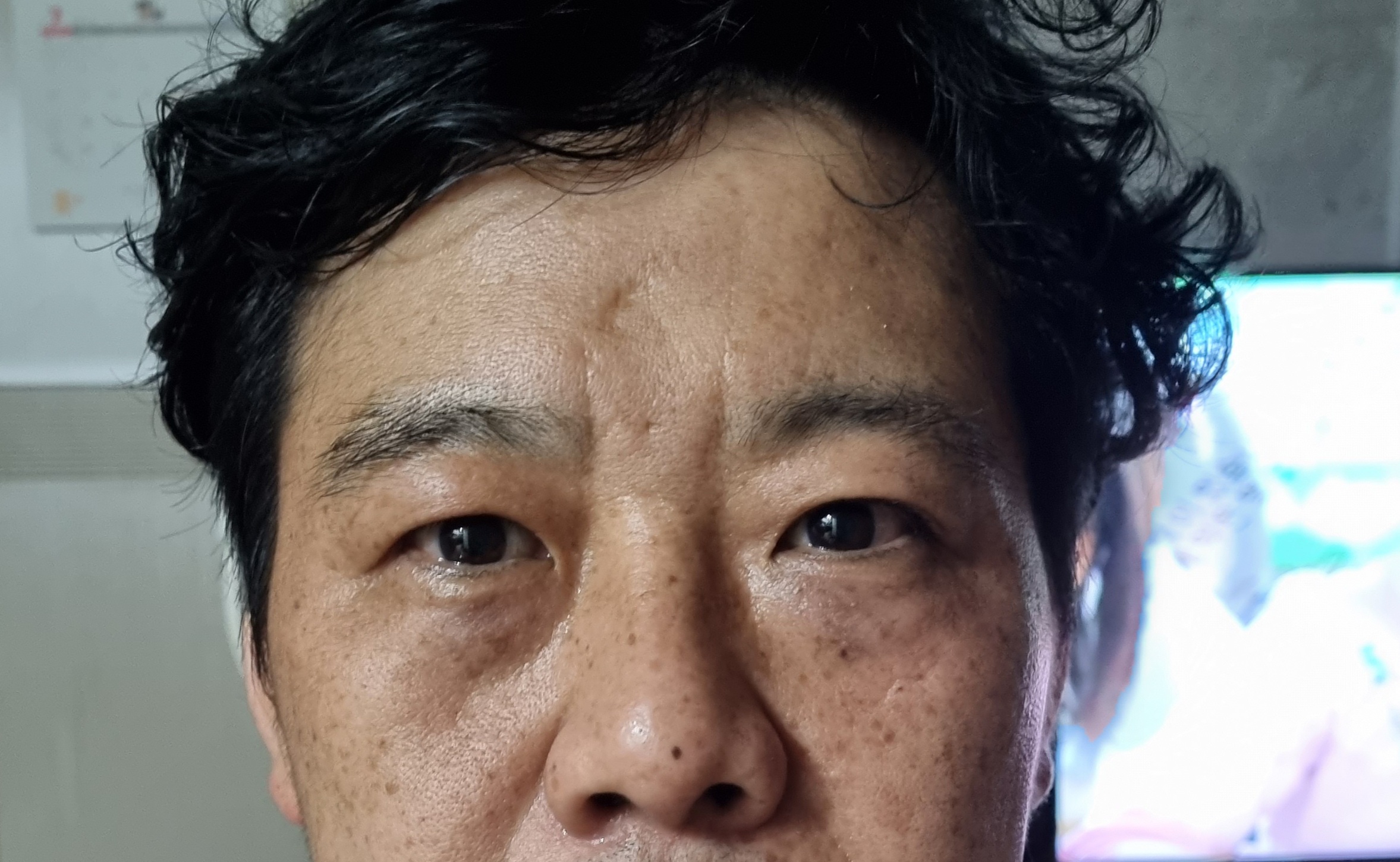 전
