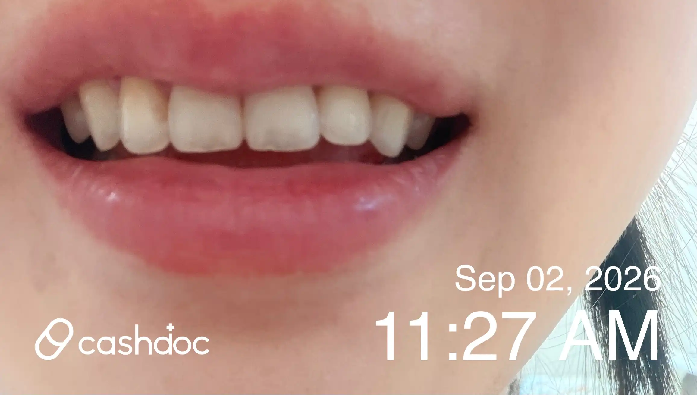 Review photo