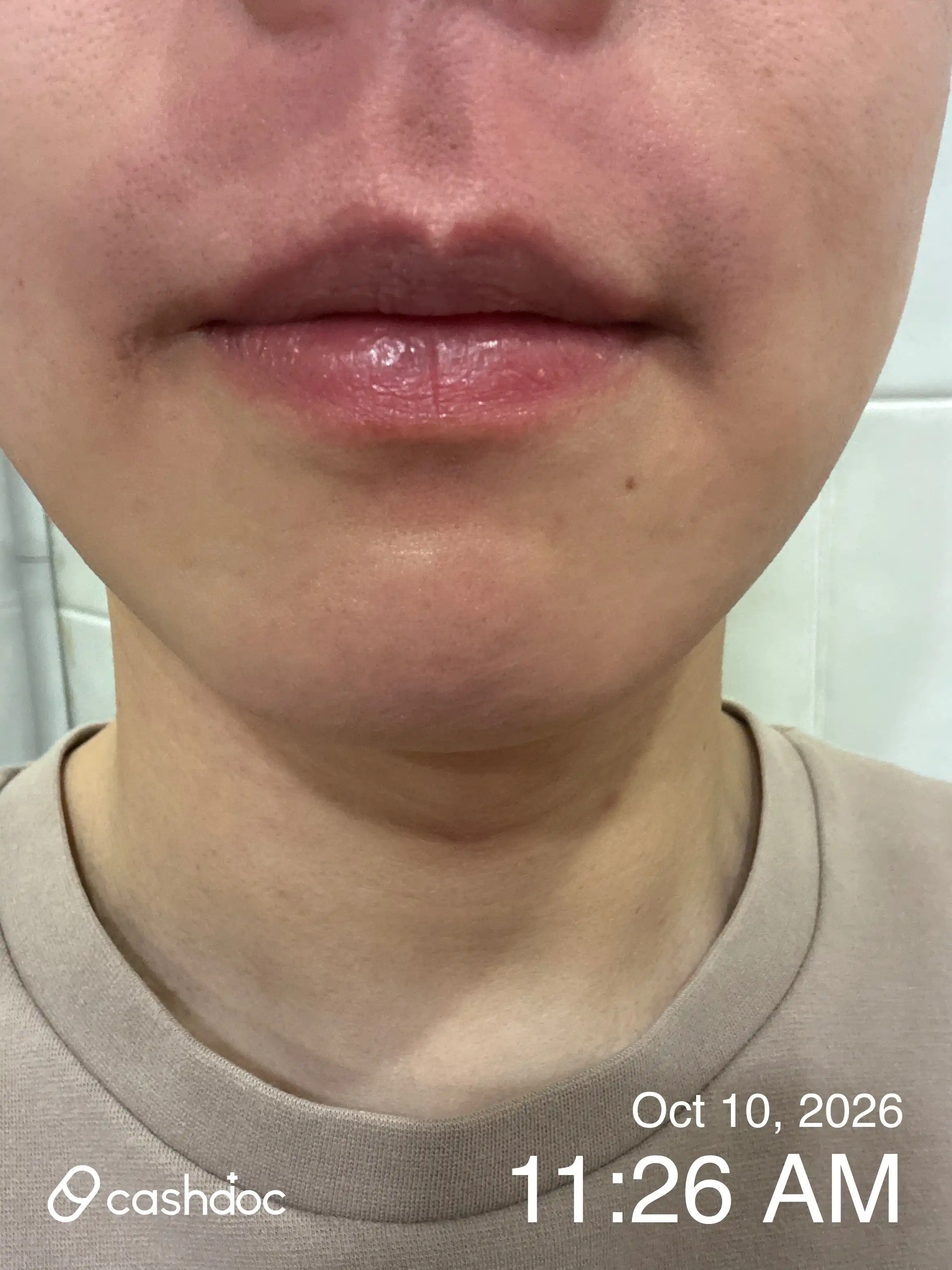 瑞博斯诊所 江南分院 评价照片