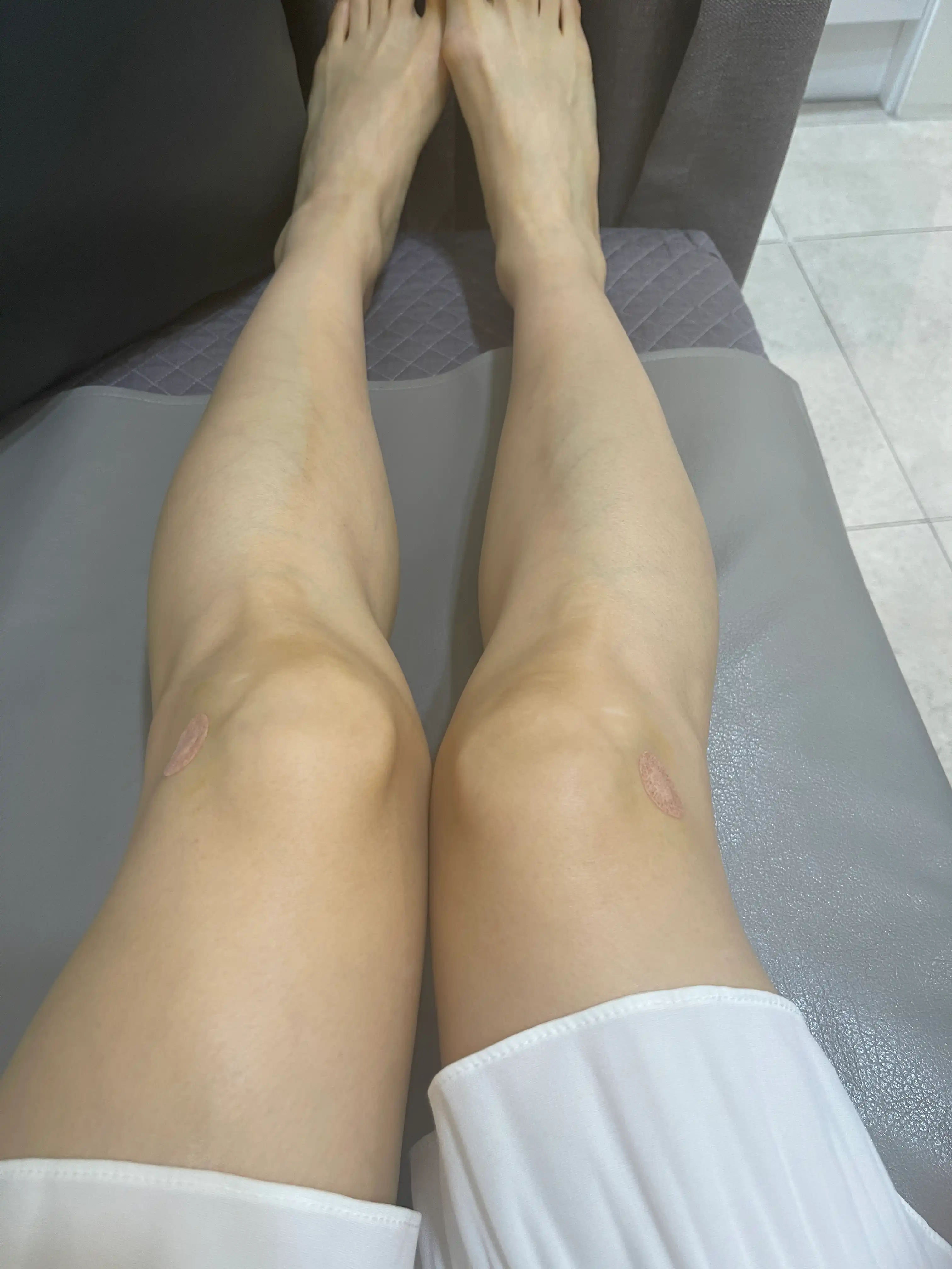 评价照片