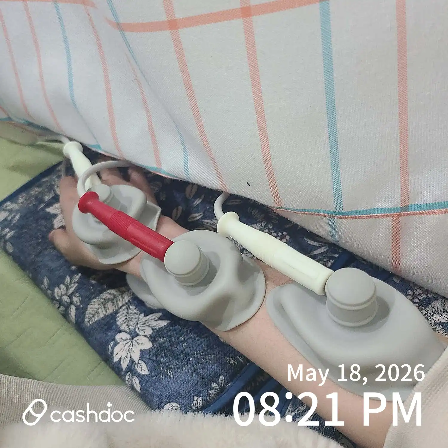 Review photo