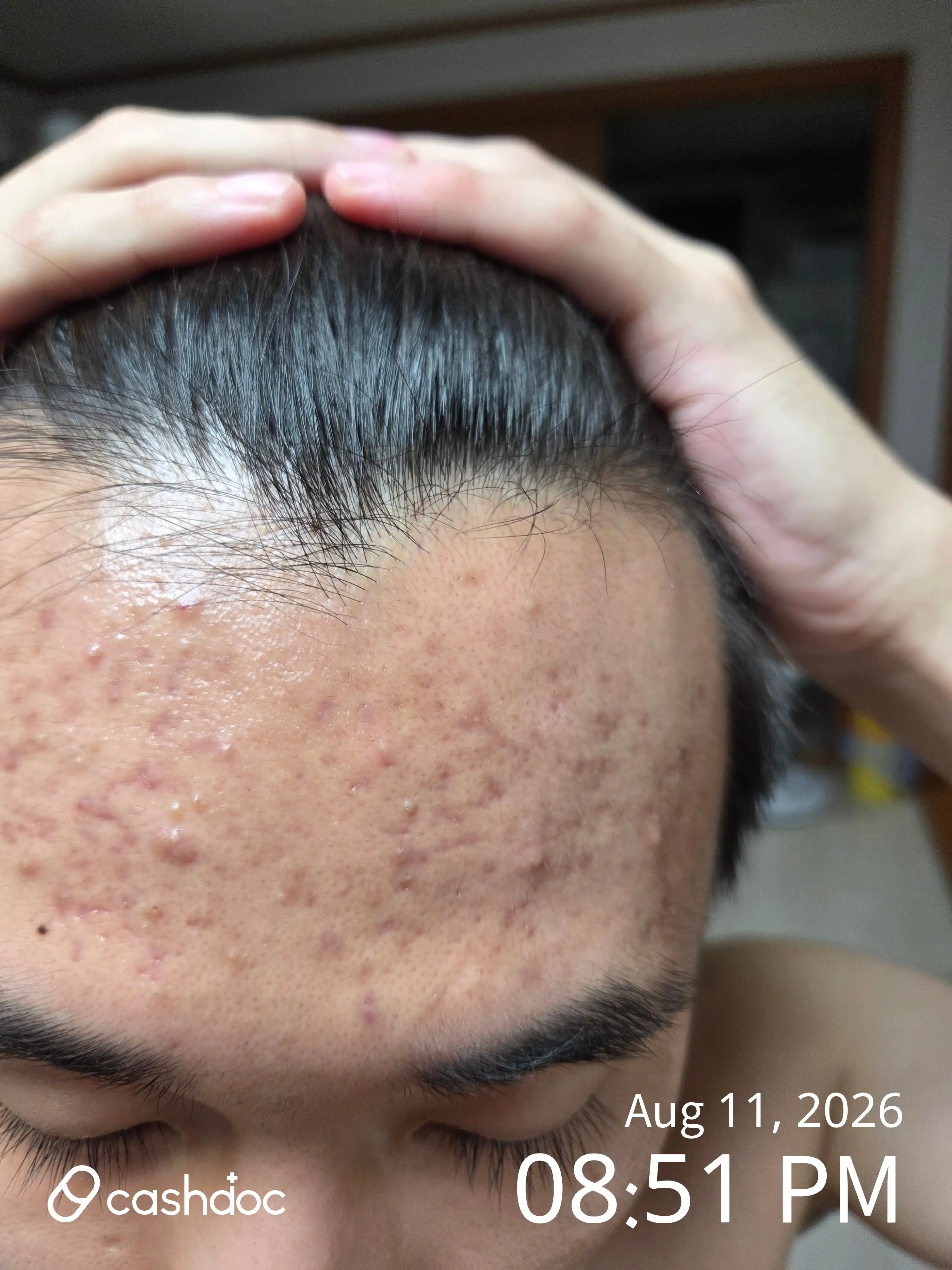 Review photo